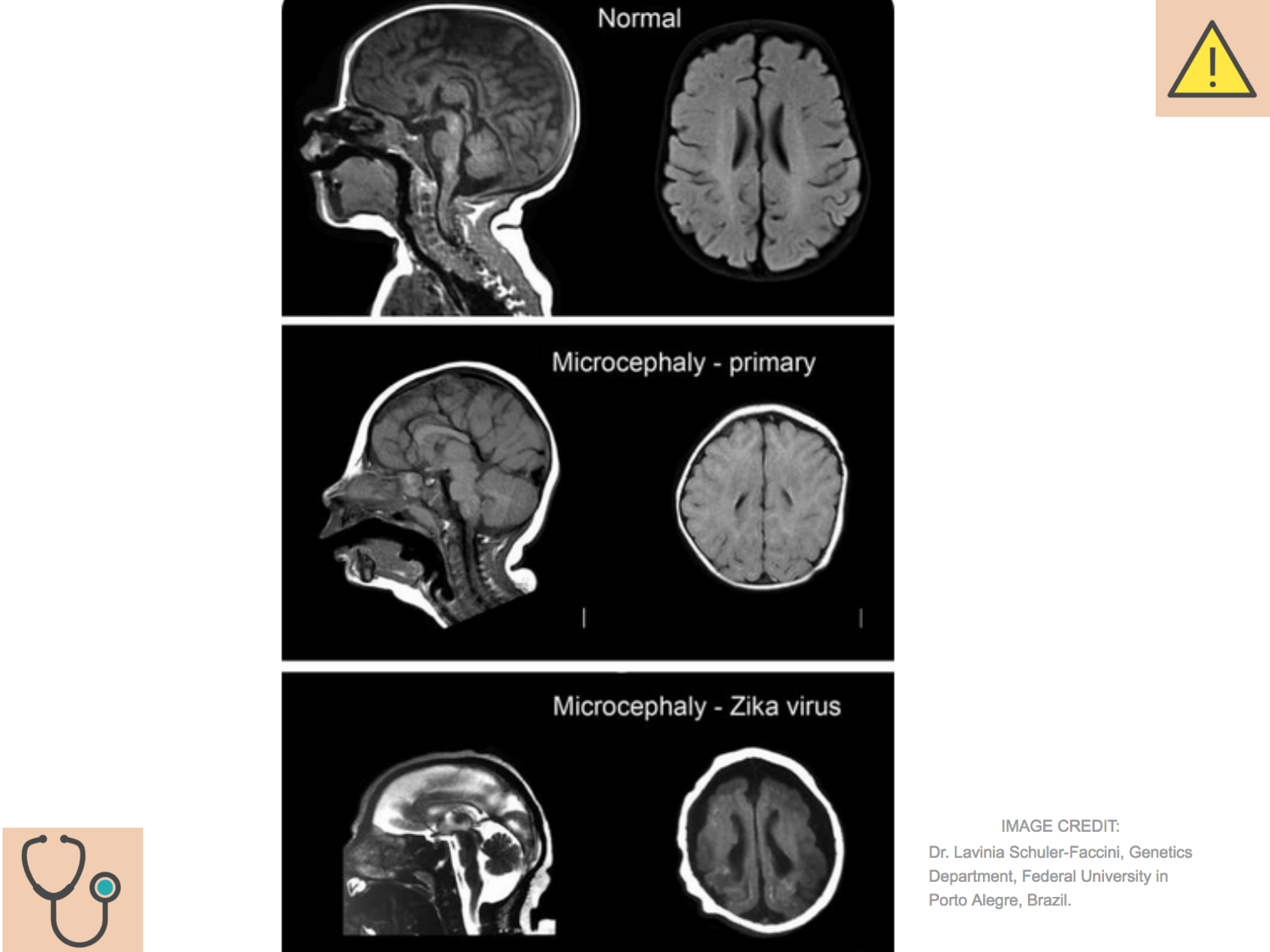 COURS 2025-2026 pdf 2024 2025 Développement du système nerveux- A. Ruiz i Altaba page 68
