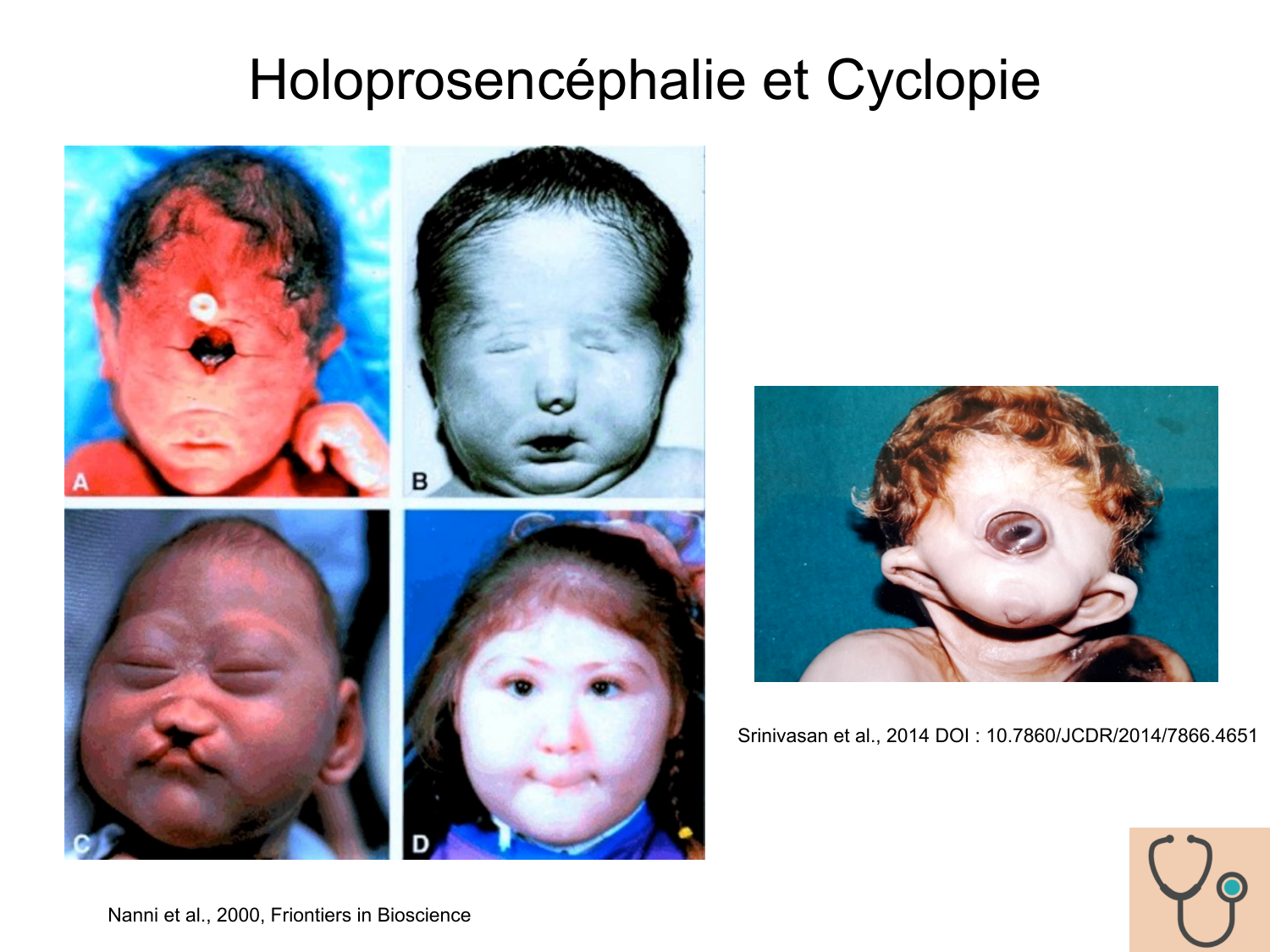 COURS 2025-2026 pdf 2024 2025 Développement du système nerveux- A. Ruiz i Altaba page 69