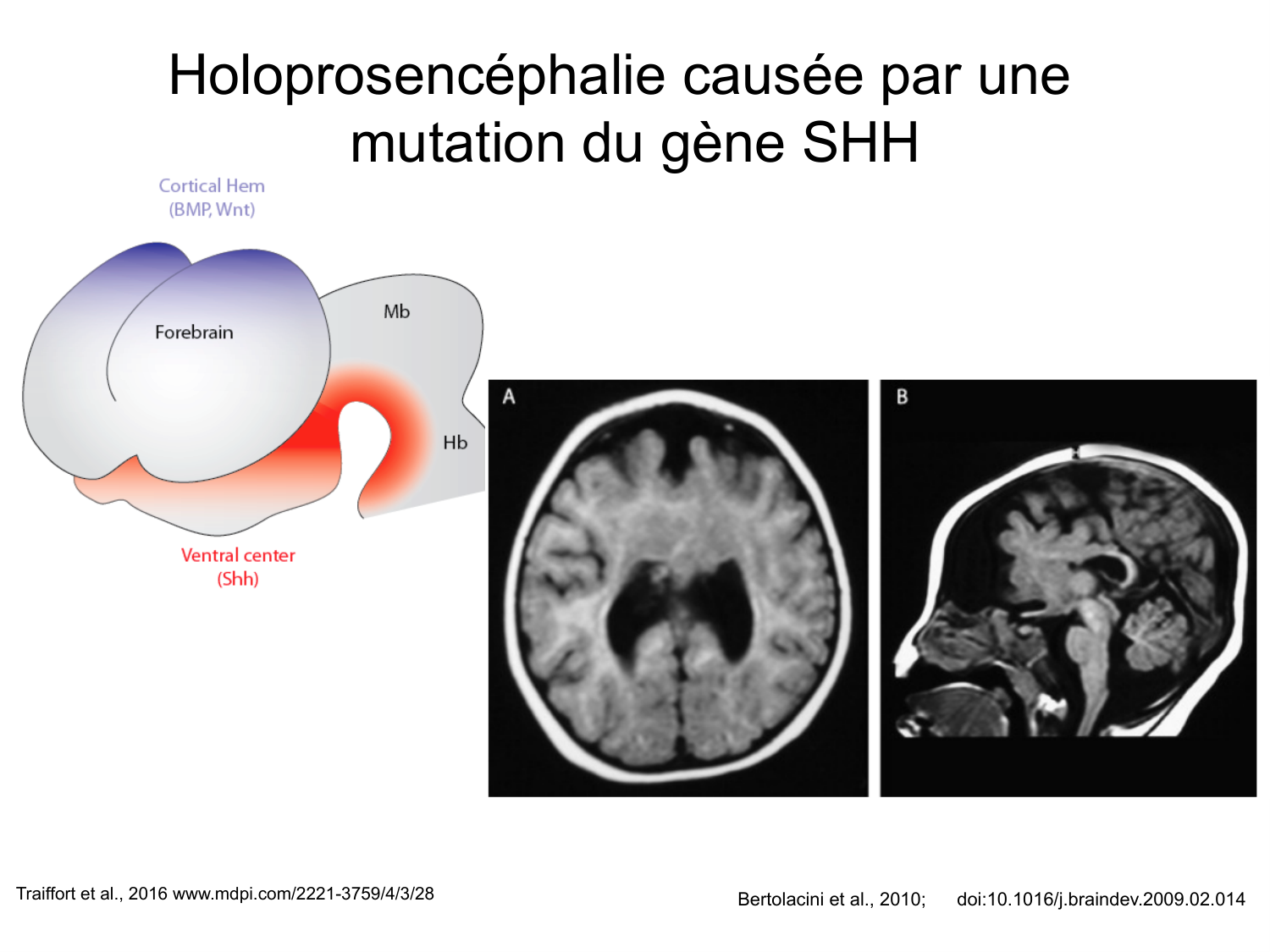 COURS 2025-2026 pdf 2024 2025 Développement du système nerveux- A. Ruiz i Altaba page 70