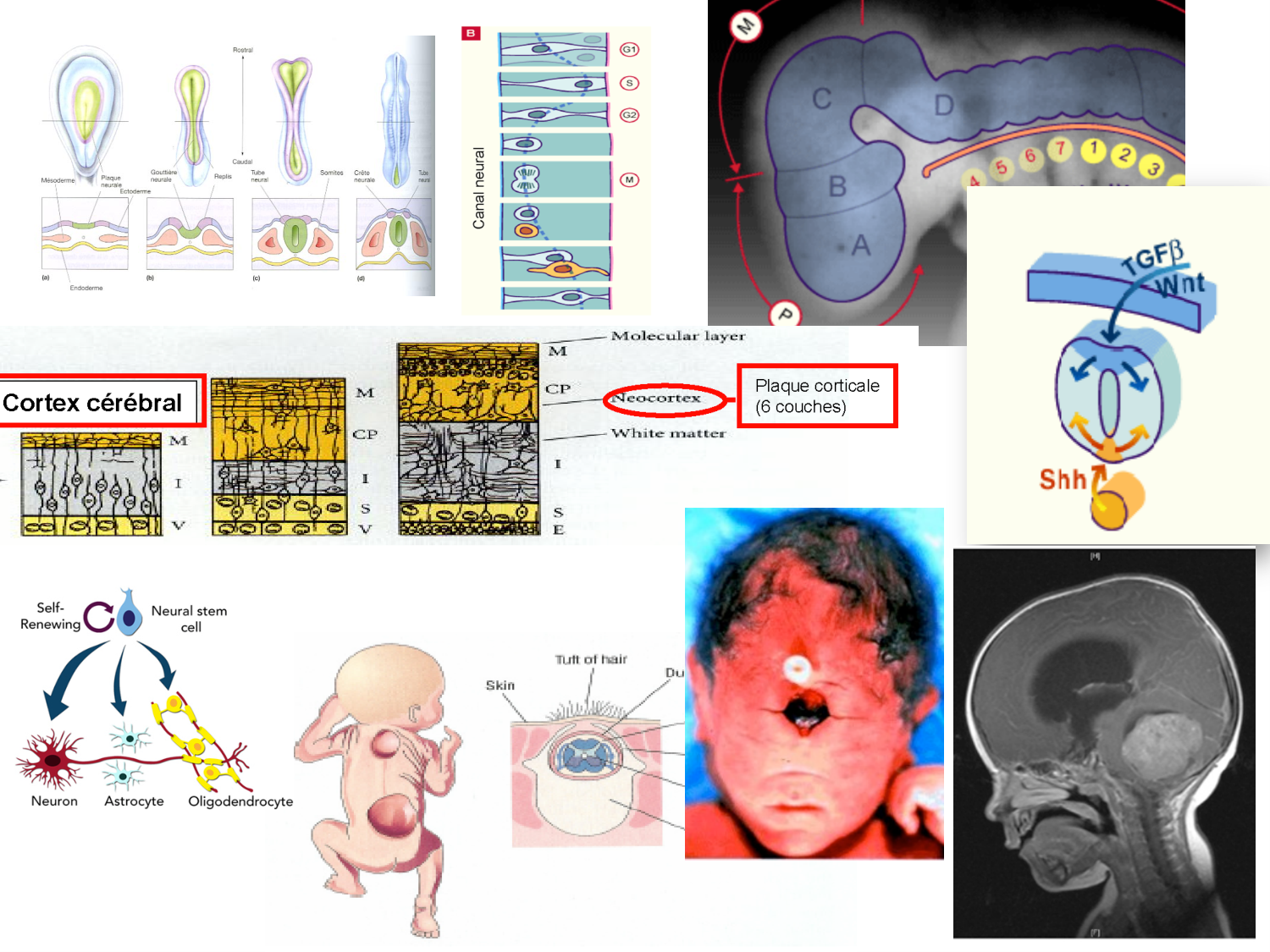 COURS 2025-2026 pdf 2024 2025 Développement du système nerveux- A. Ruiz i Altaba page 72