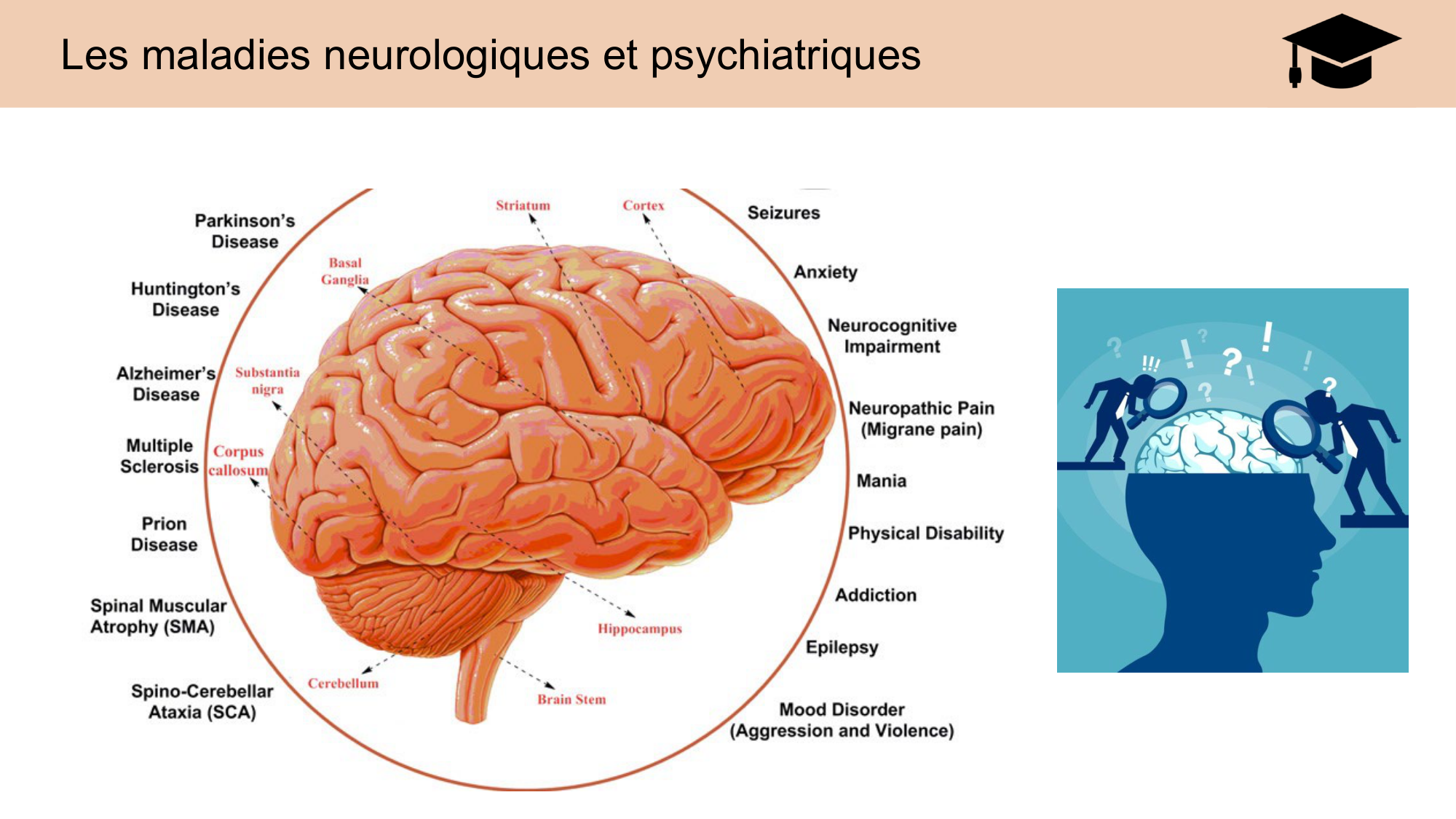 CARLETON JABAUDON cours 2024 etats internes et maladies neurologiques page 12