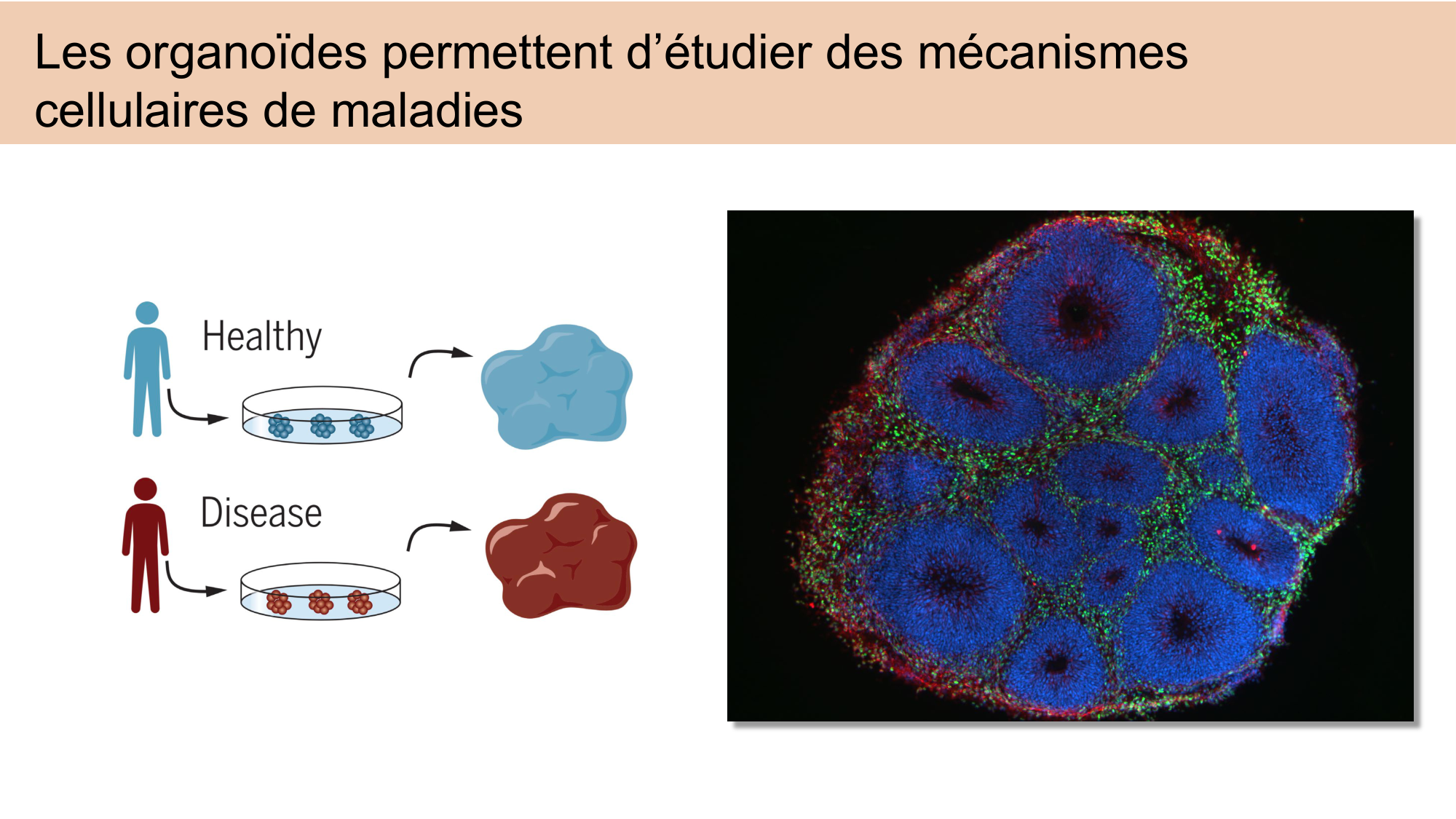 CARLETON JABAUDON cours 2024 etats internes et maladies neurologiques page 20