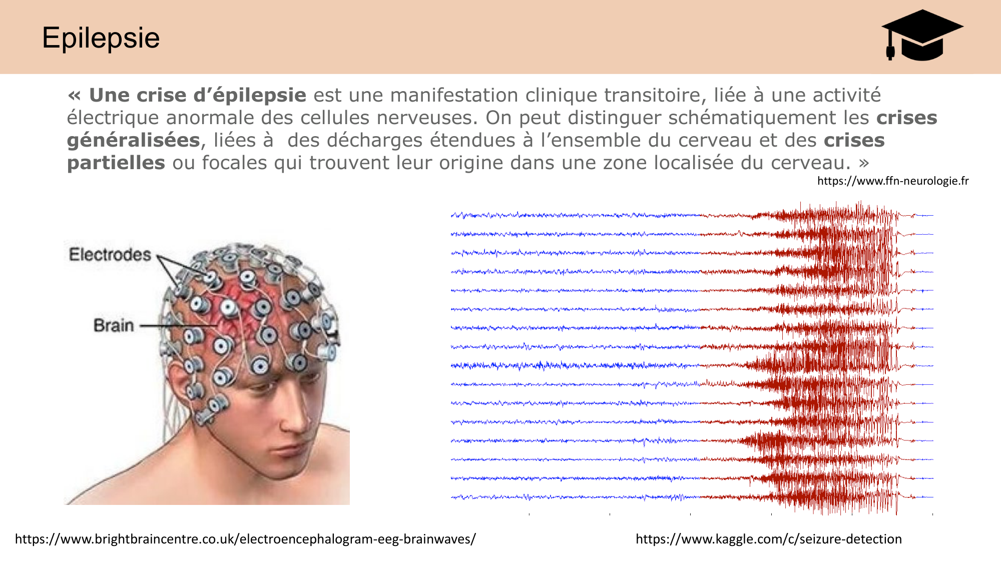 CARLETON JABAUDON cours 2024 etats internes et maladies neurologiques page 23