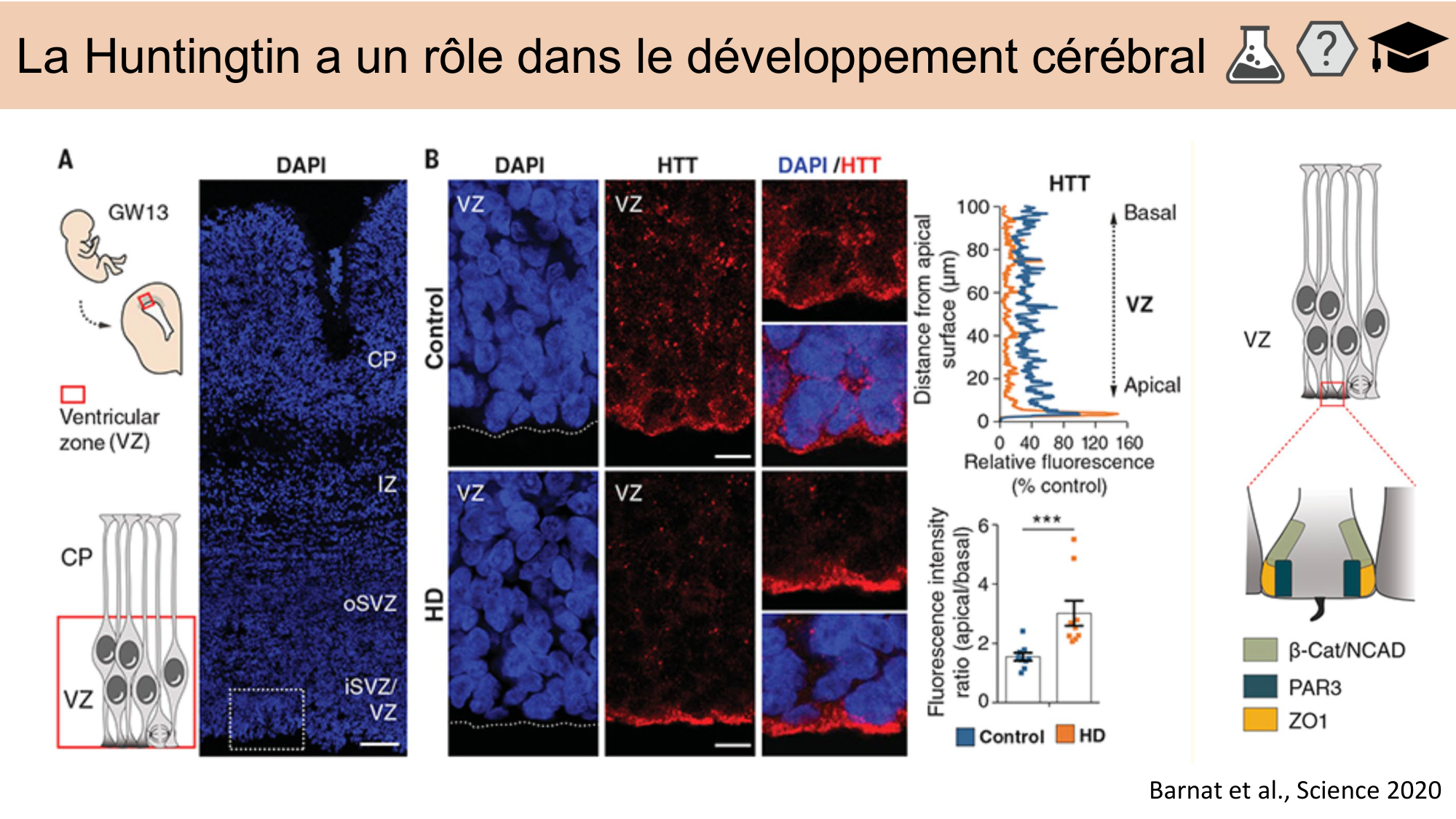 CARLETON JABAUDON cours 2024 etats internes et maladies neurologiques page 33