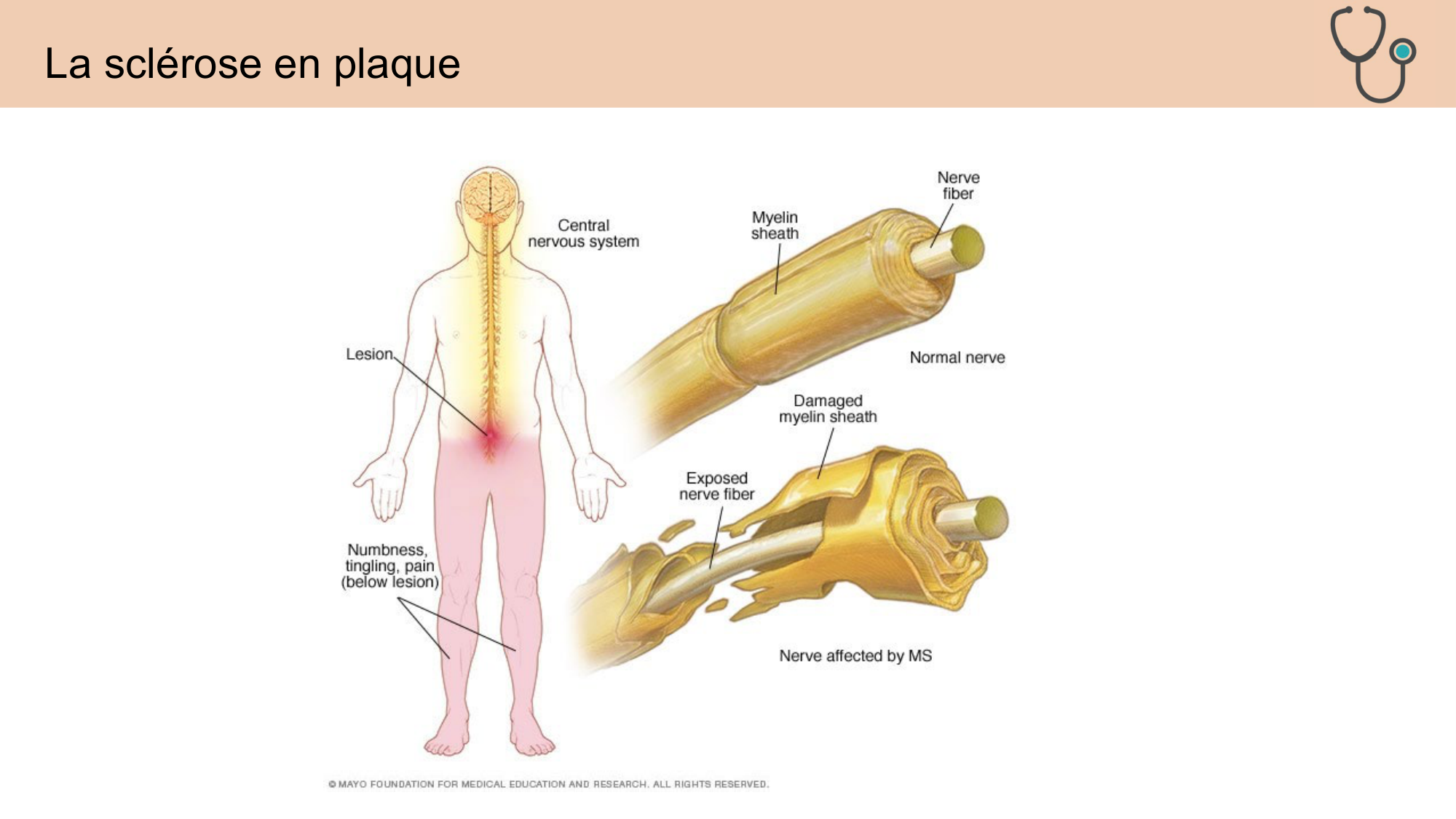 CARLETON JABAUDON cours 2024 etats internes et maladies neurologiques page 38