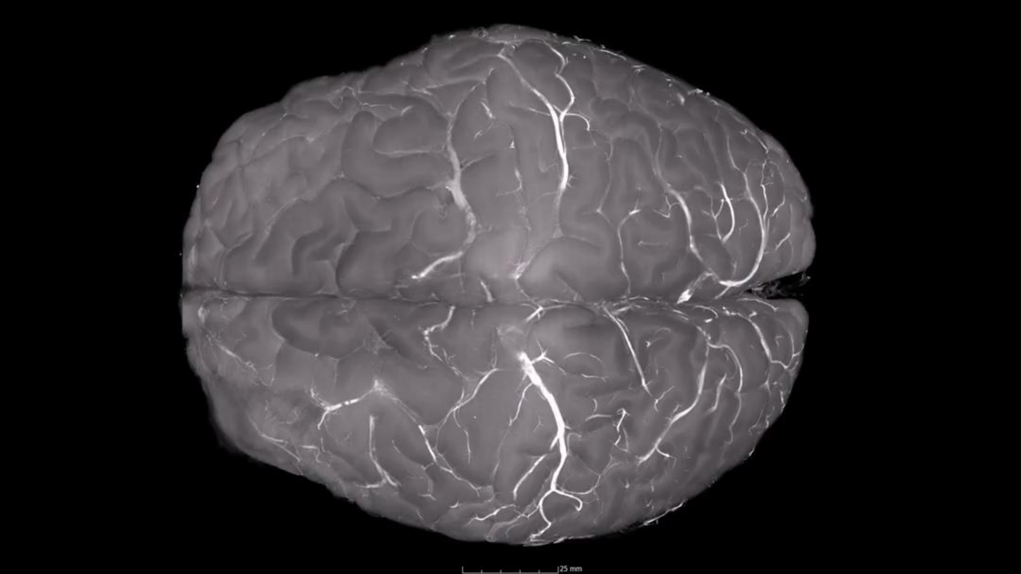 Jabaudon Cours 1 page 7