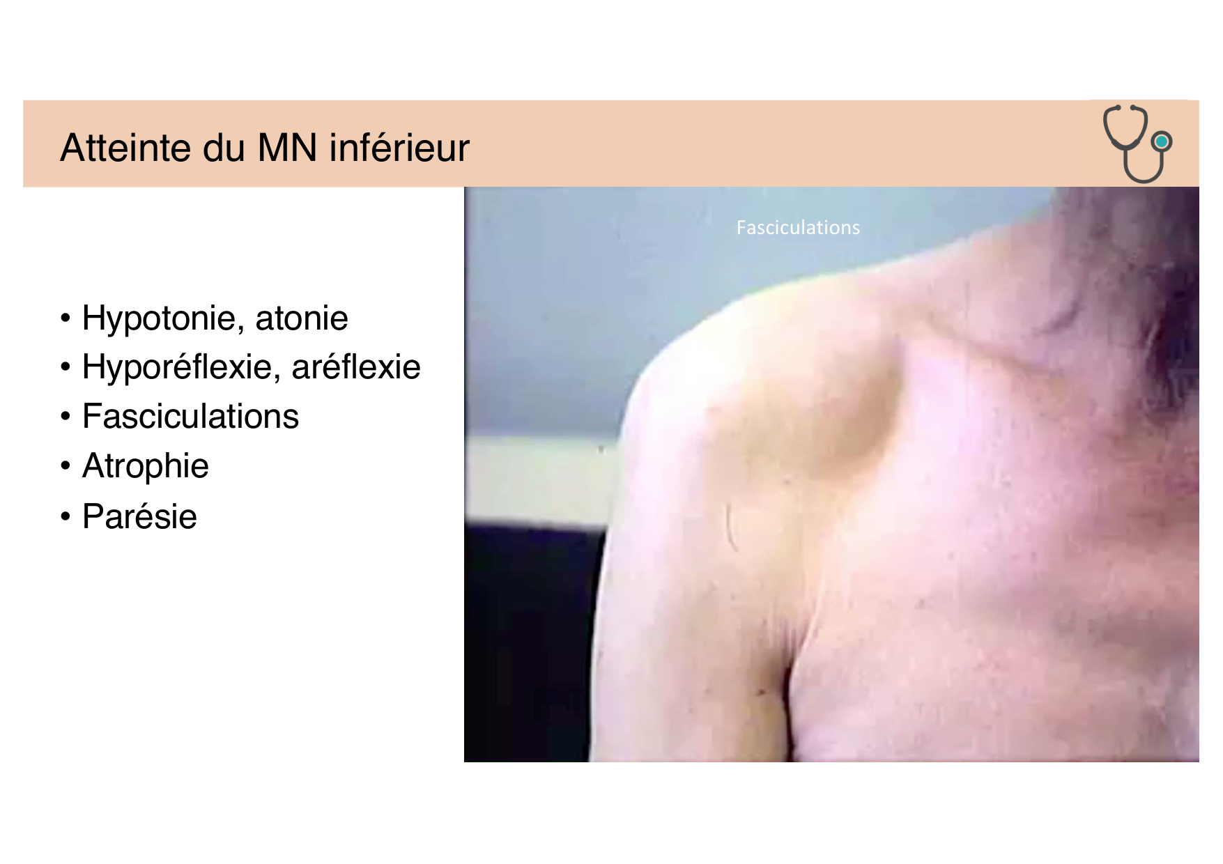 Jabaudon Cours Moteur Sensitif page 23