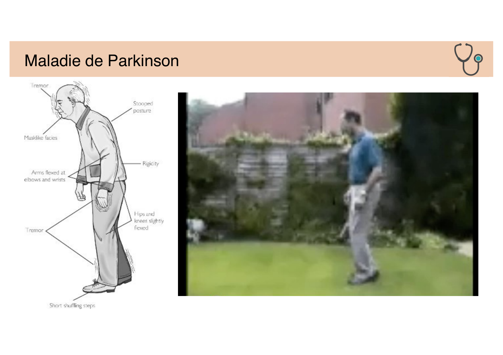 Jabaudon Cours Moteur Sensitif page 36