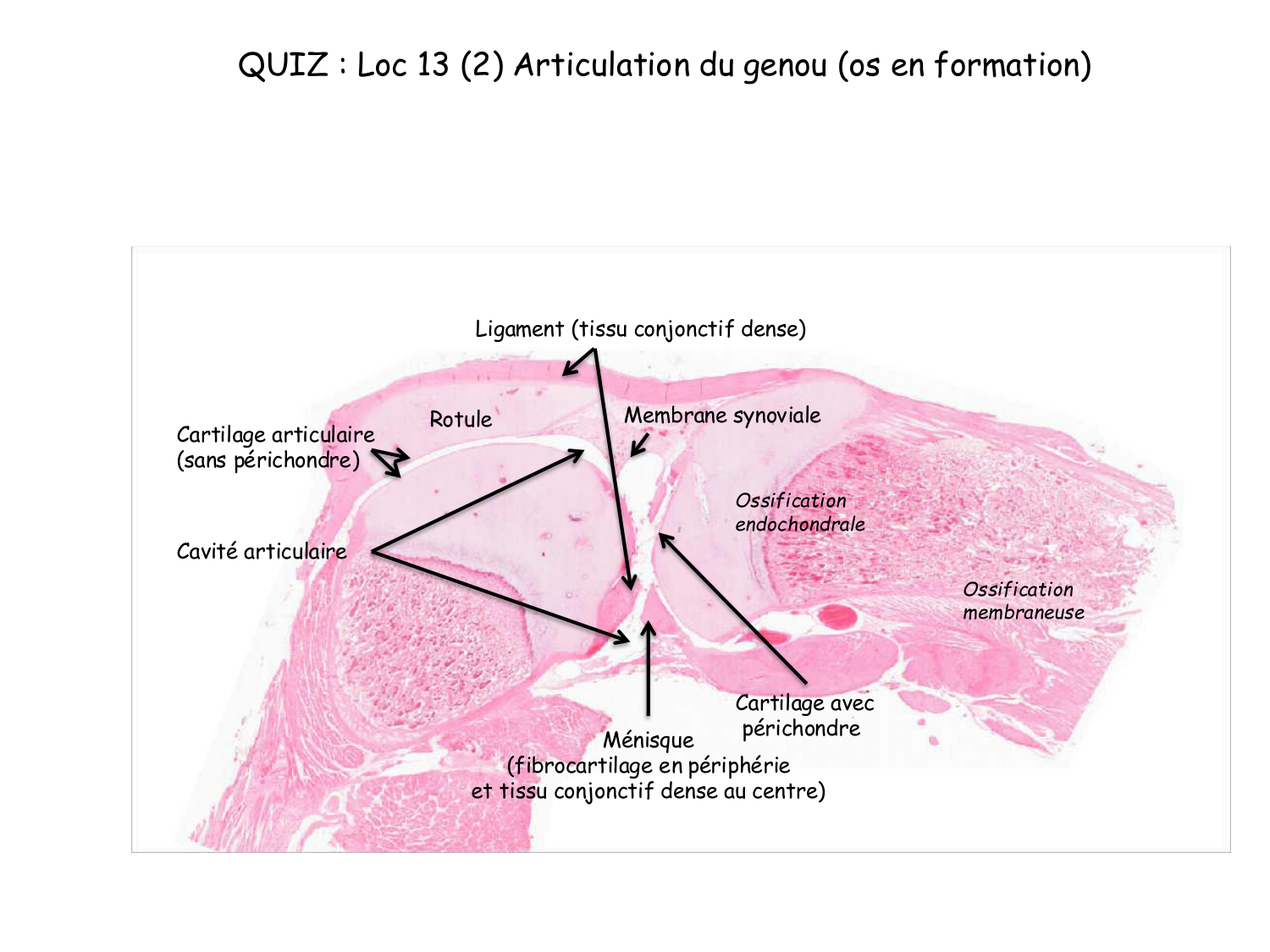 Correction TP — os et cartilage page 3