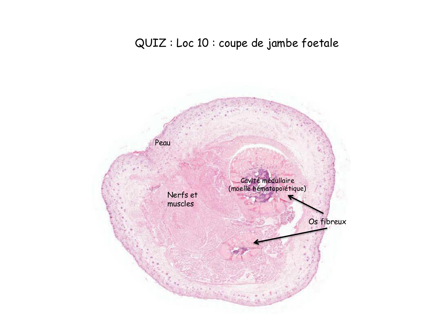 Correction TP — os et cartilage page 4