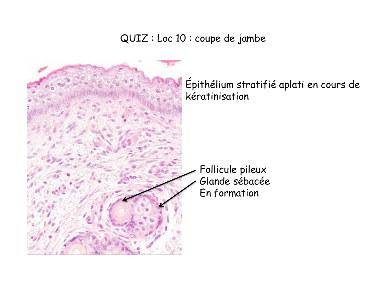 Correction TP — os et cartilage page 6