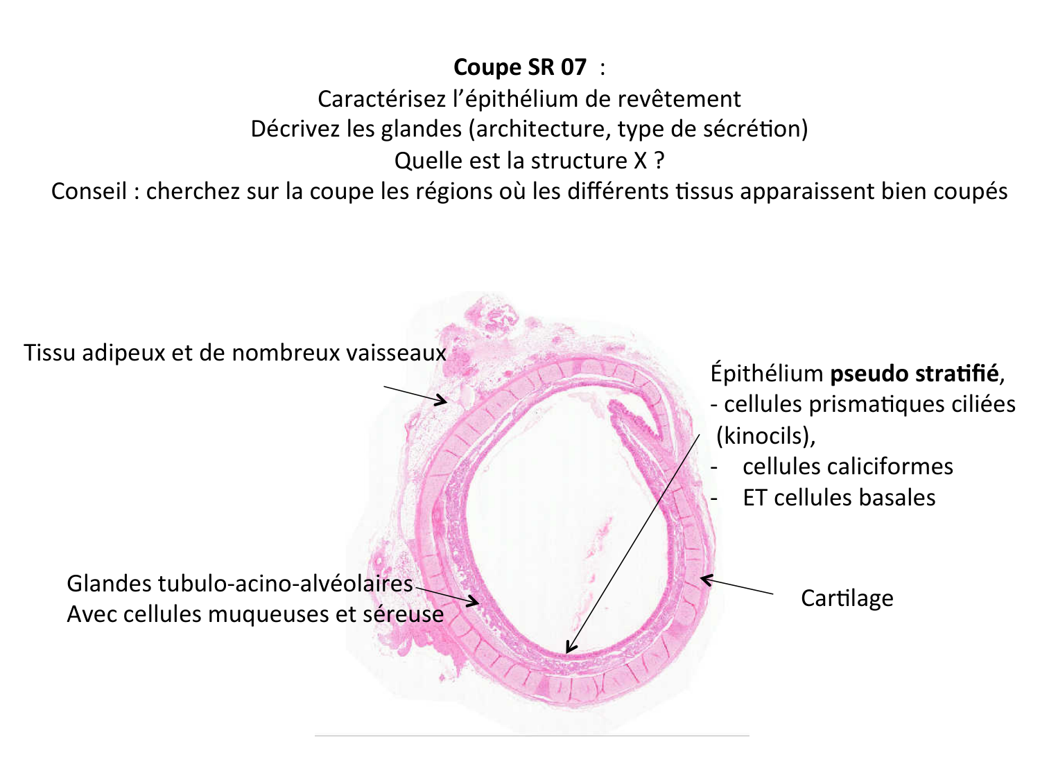 Correction quiz TC page 4