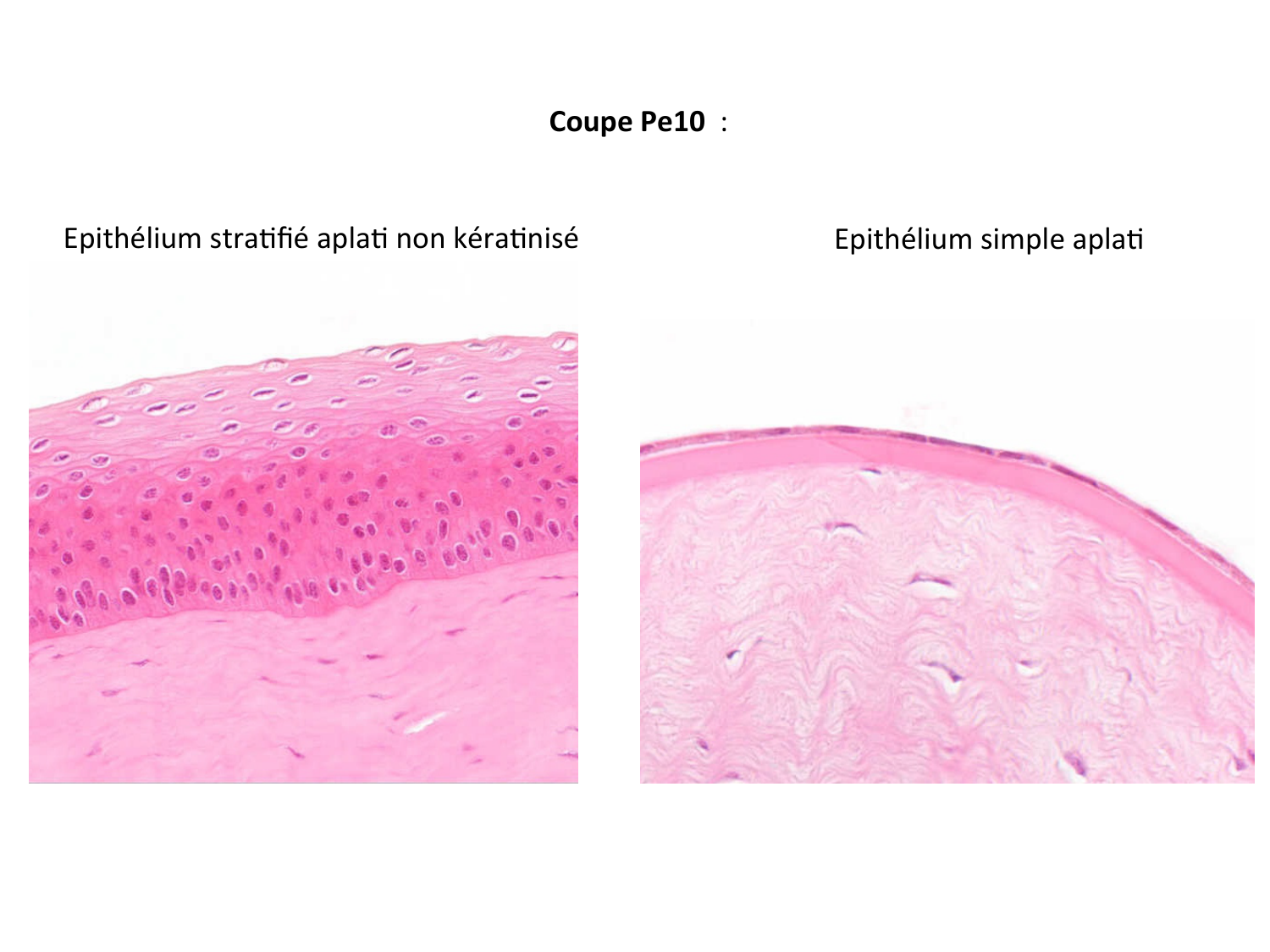 Correction TP — épithélium page 2