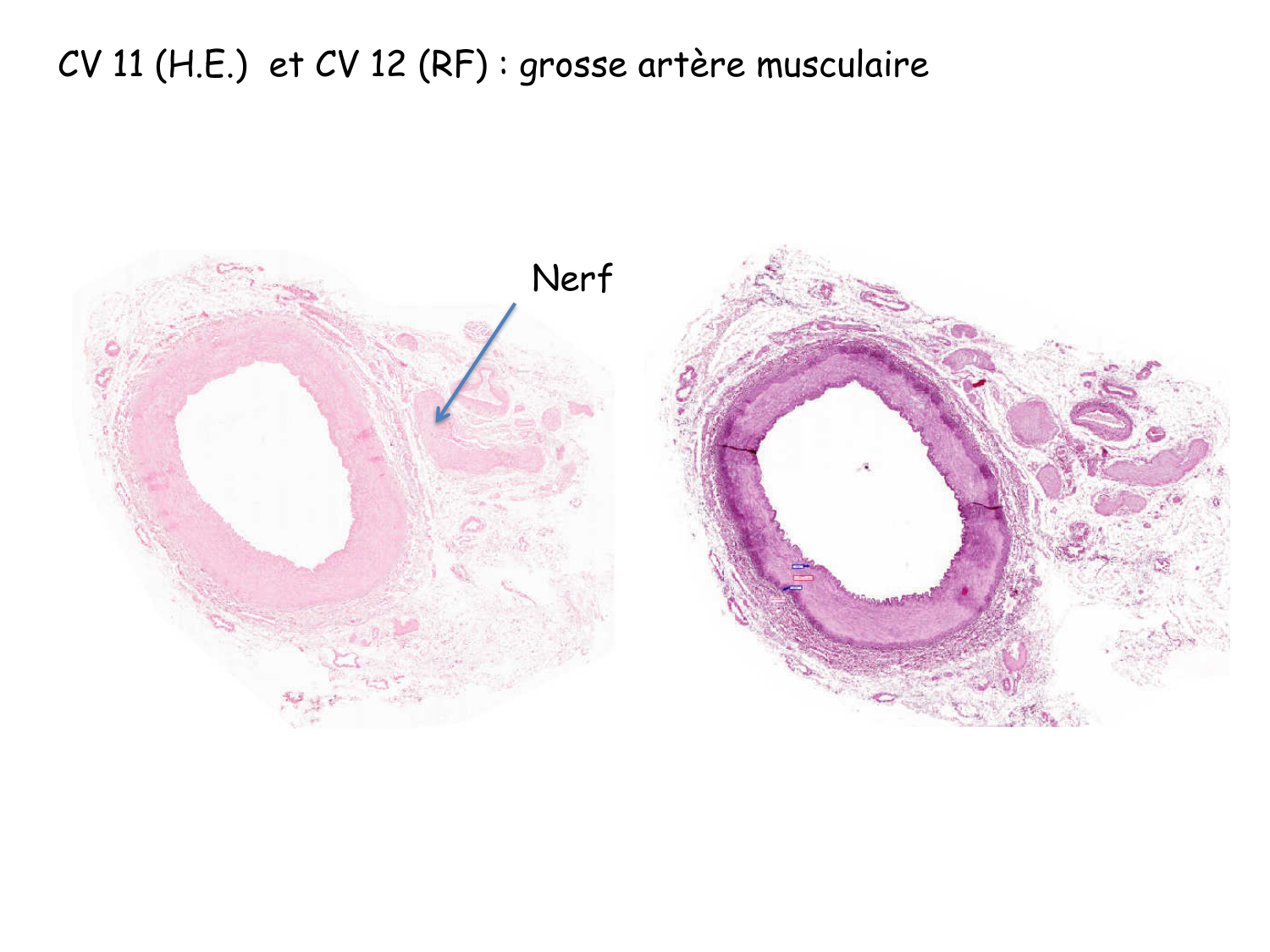 Correction TP — sang et vaisseaux page 1
