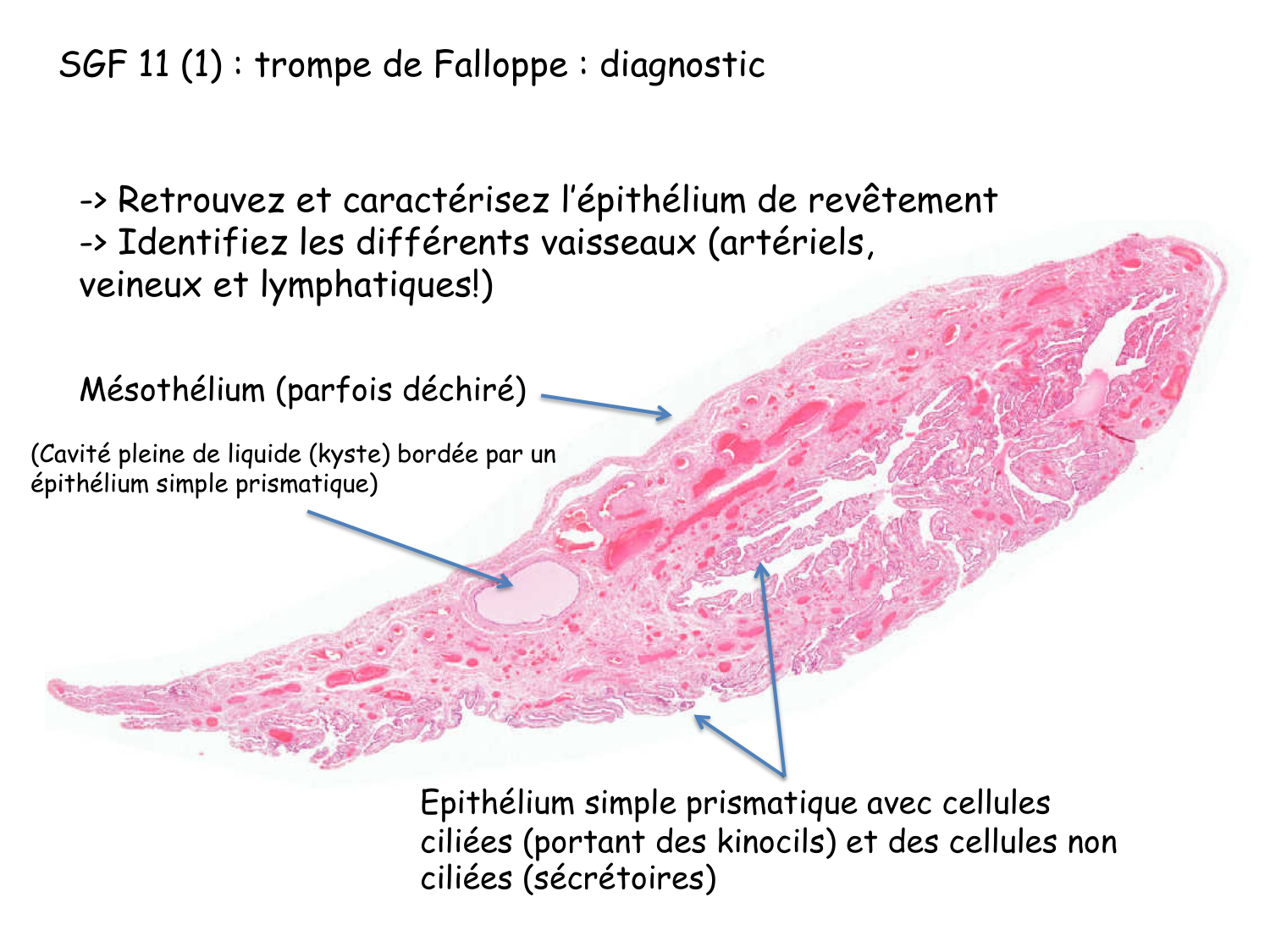 Correction TP — sang et vaisseaux page 2