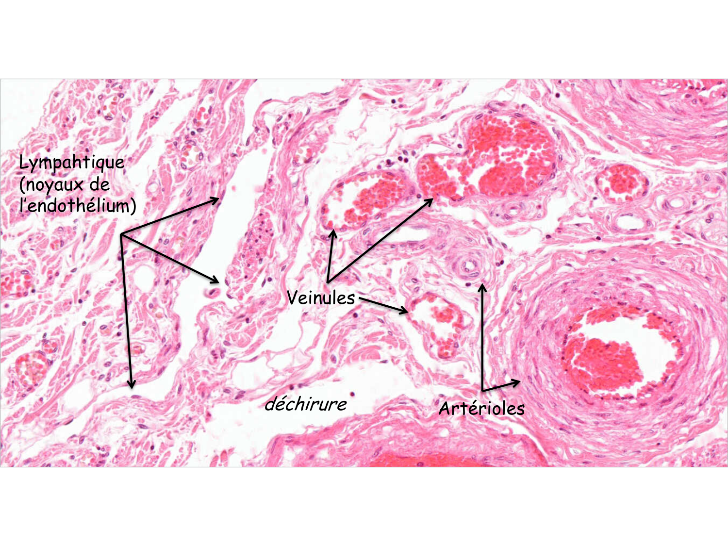 Correction TP — sang et vaisseaux page 3