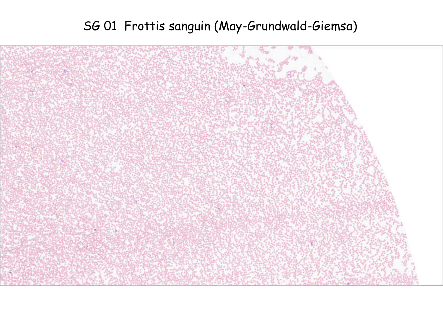 TP histologie — sang page 28