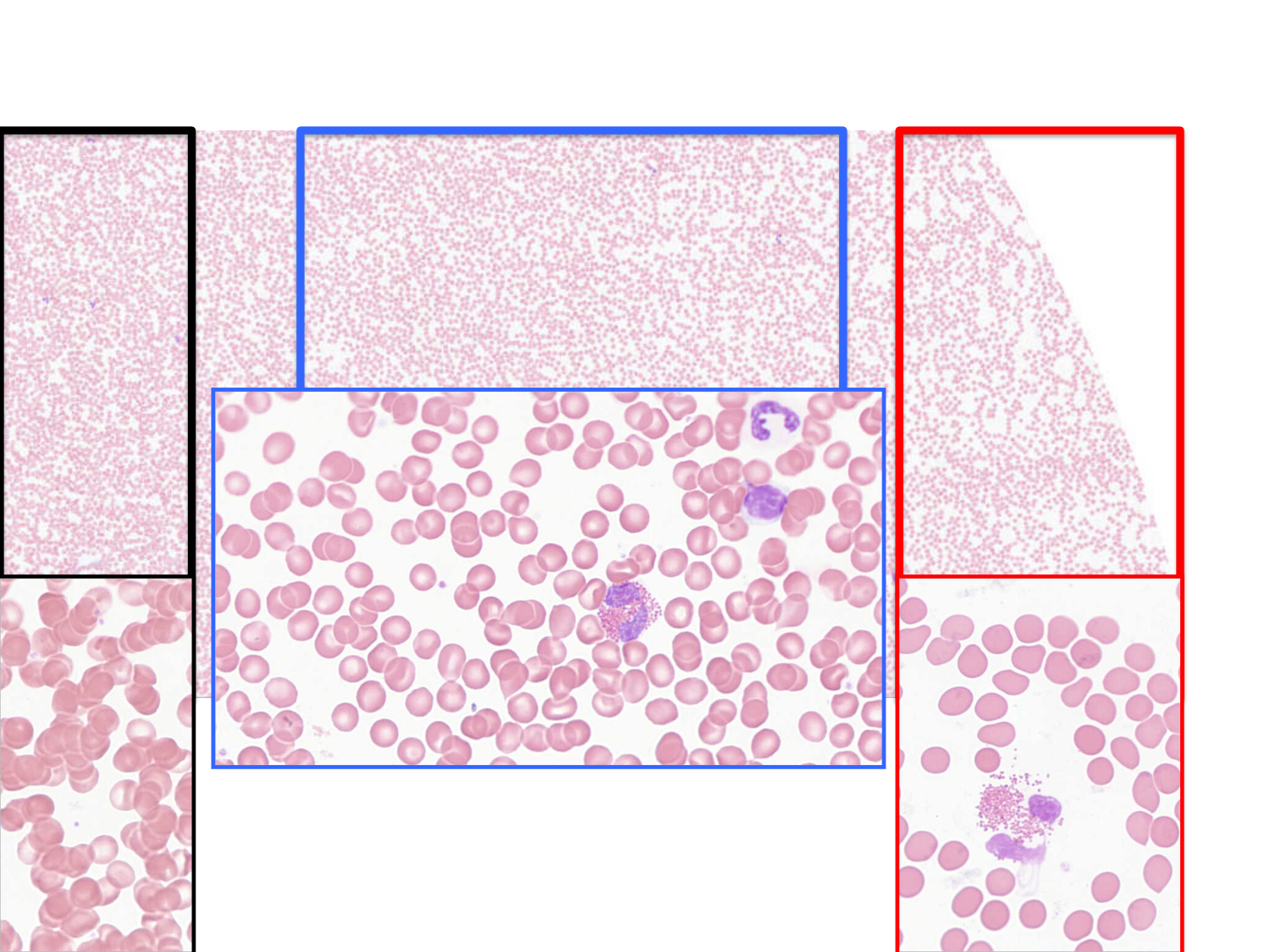 TP histologie — sang page 29