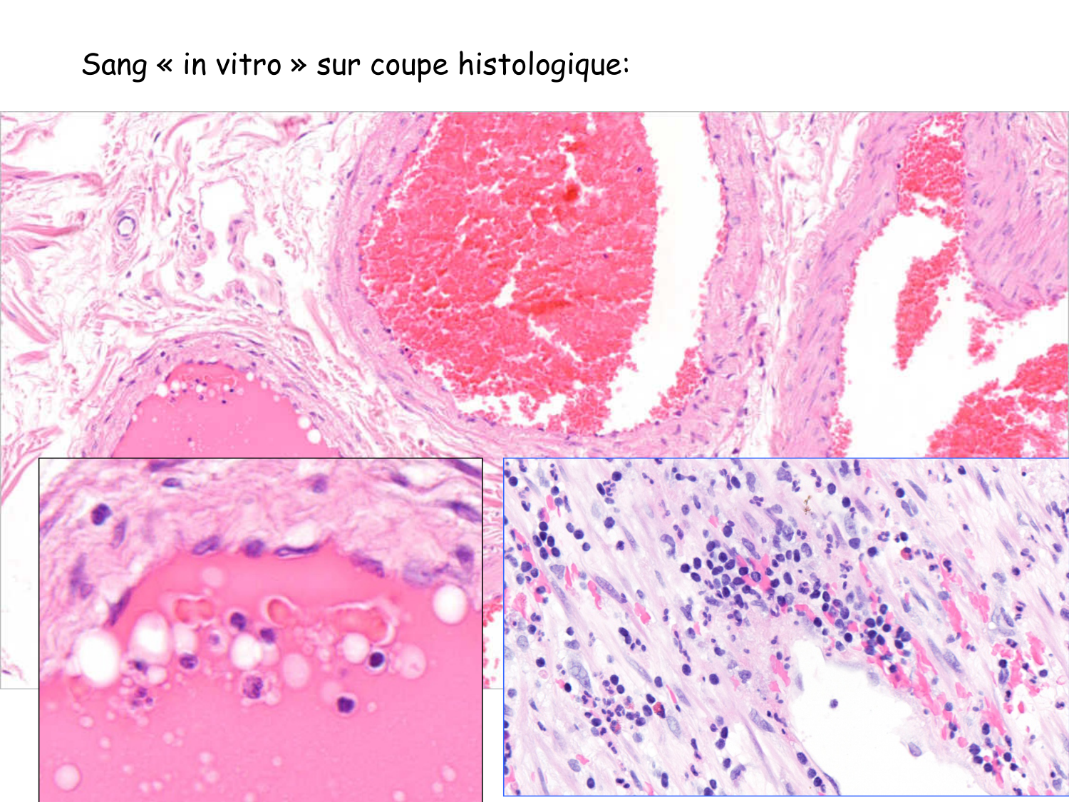 TP histologie — sang page 31
