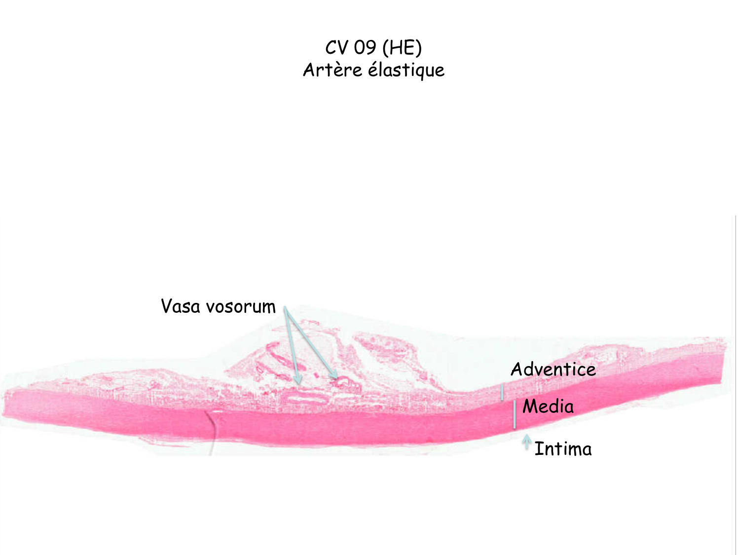 TP histologie — système circulatoire page 23