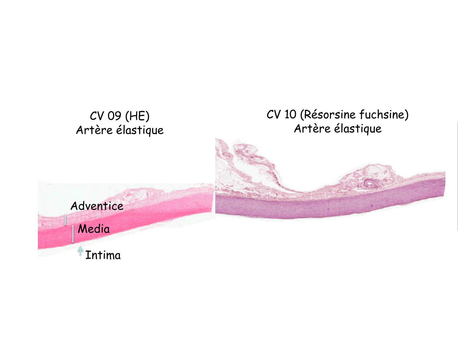 TP histologie — système circulatoire page 27