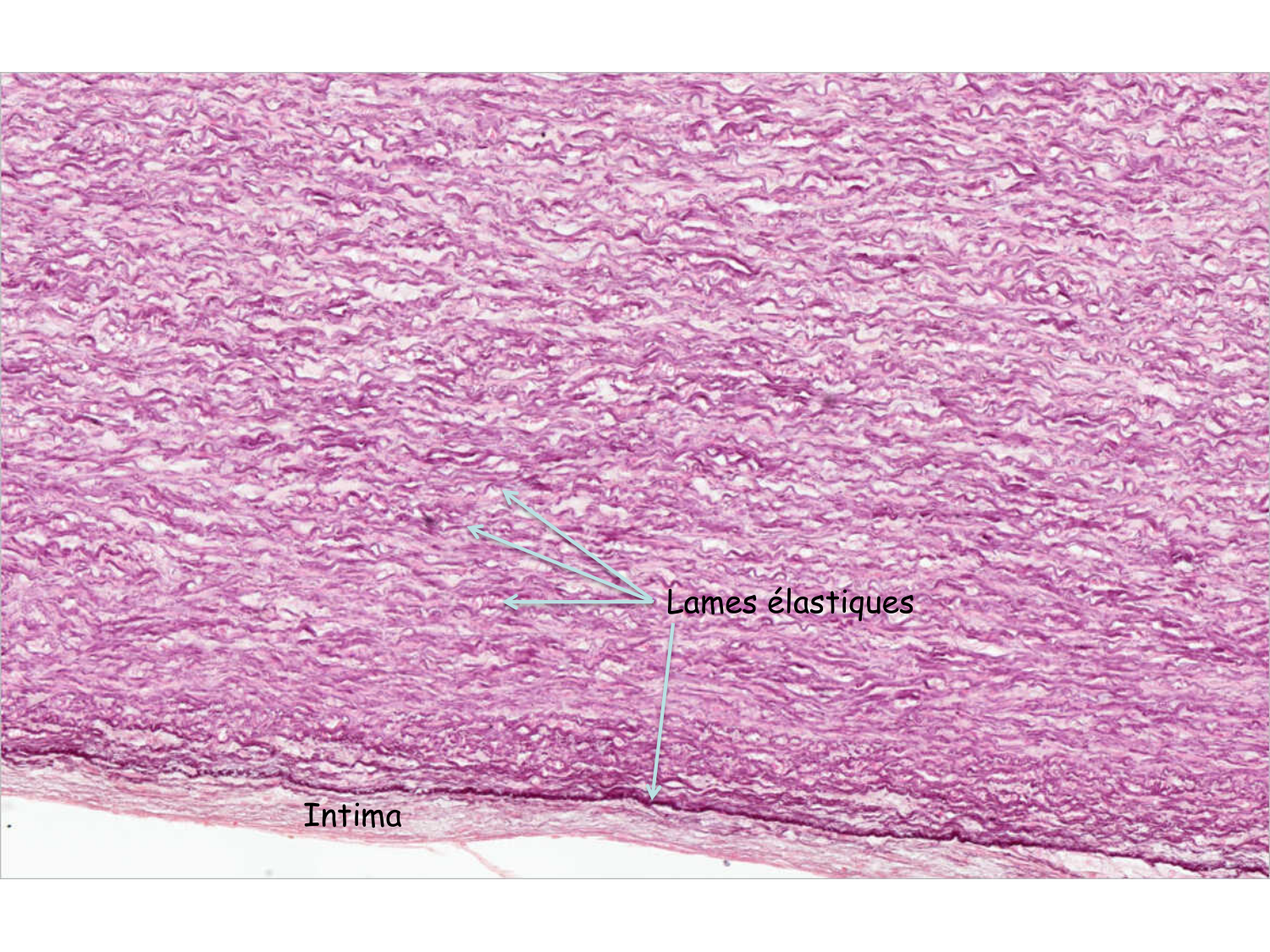 TP histologie — système circulatoire page 28