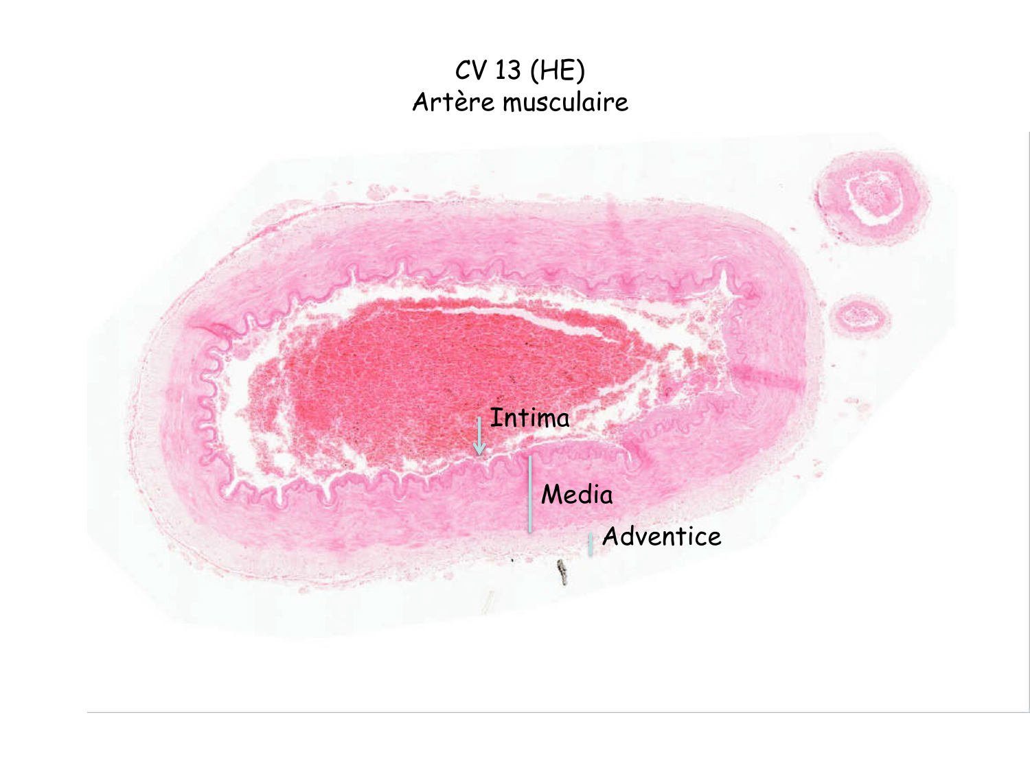 TP histologie — système circulatoire page 32