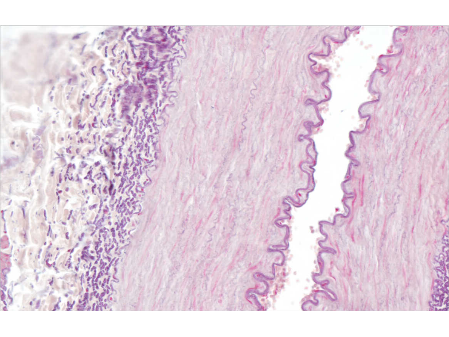 TP histologie — système circulatoire page 35
