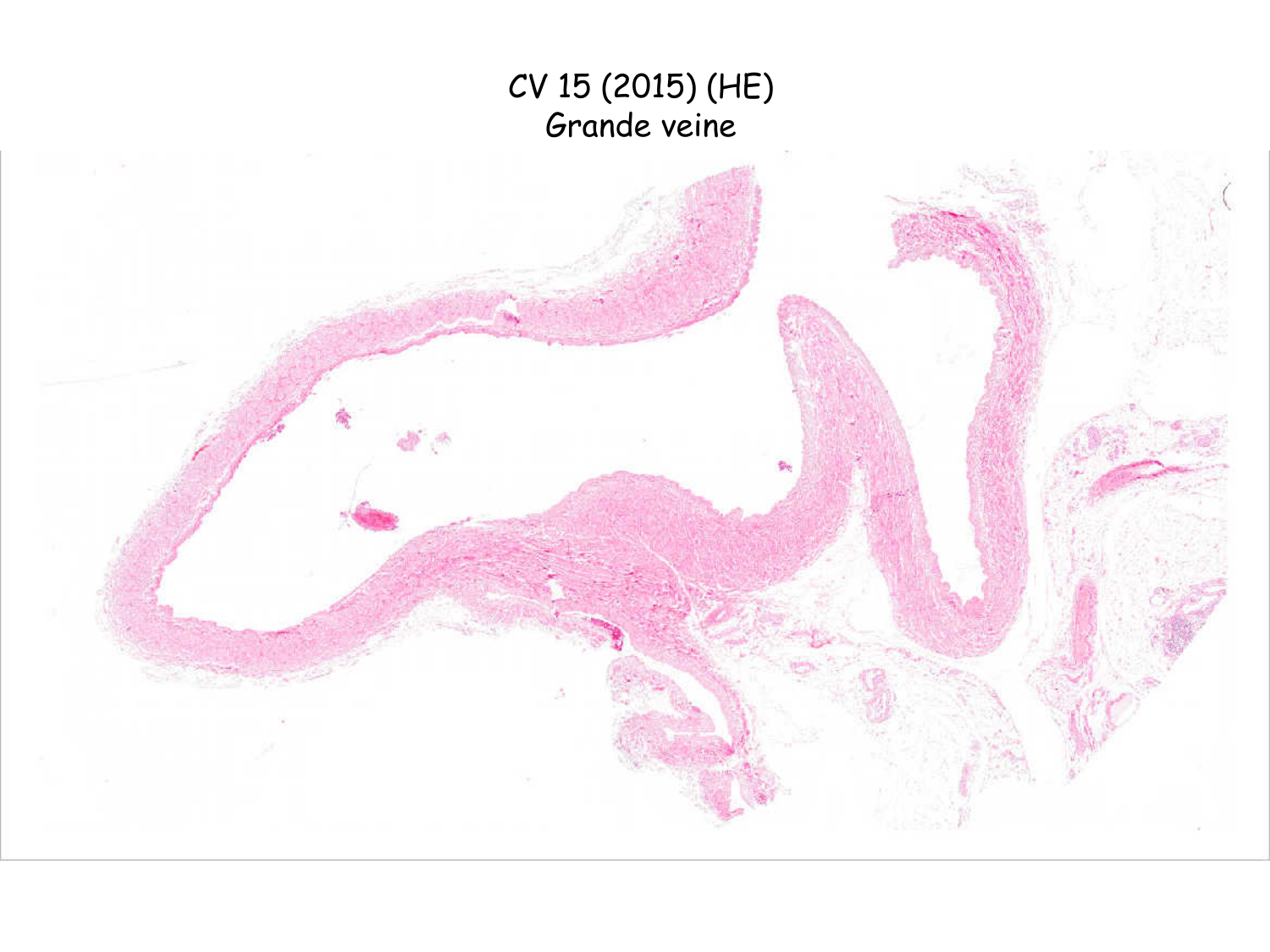 TP histologie — système circulatoire page 43