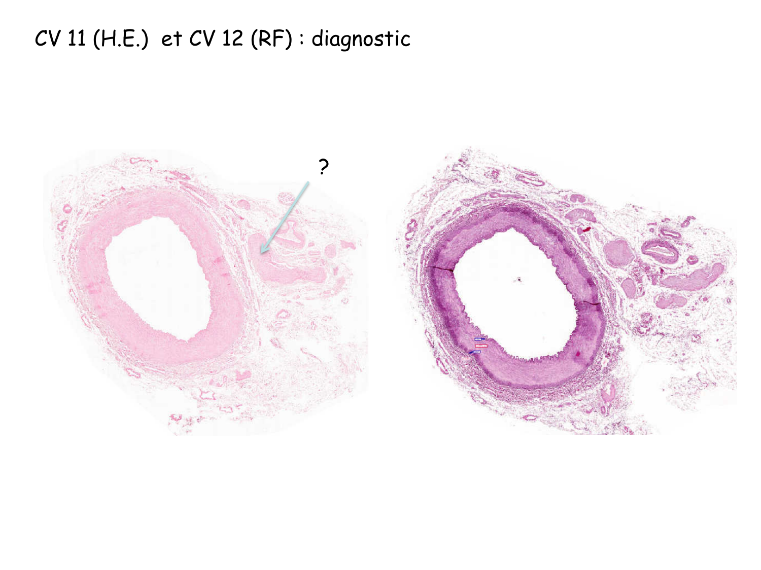 TP histologie — système circulatoire page 57