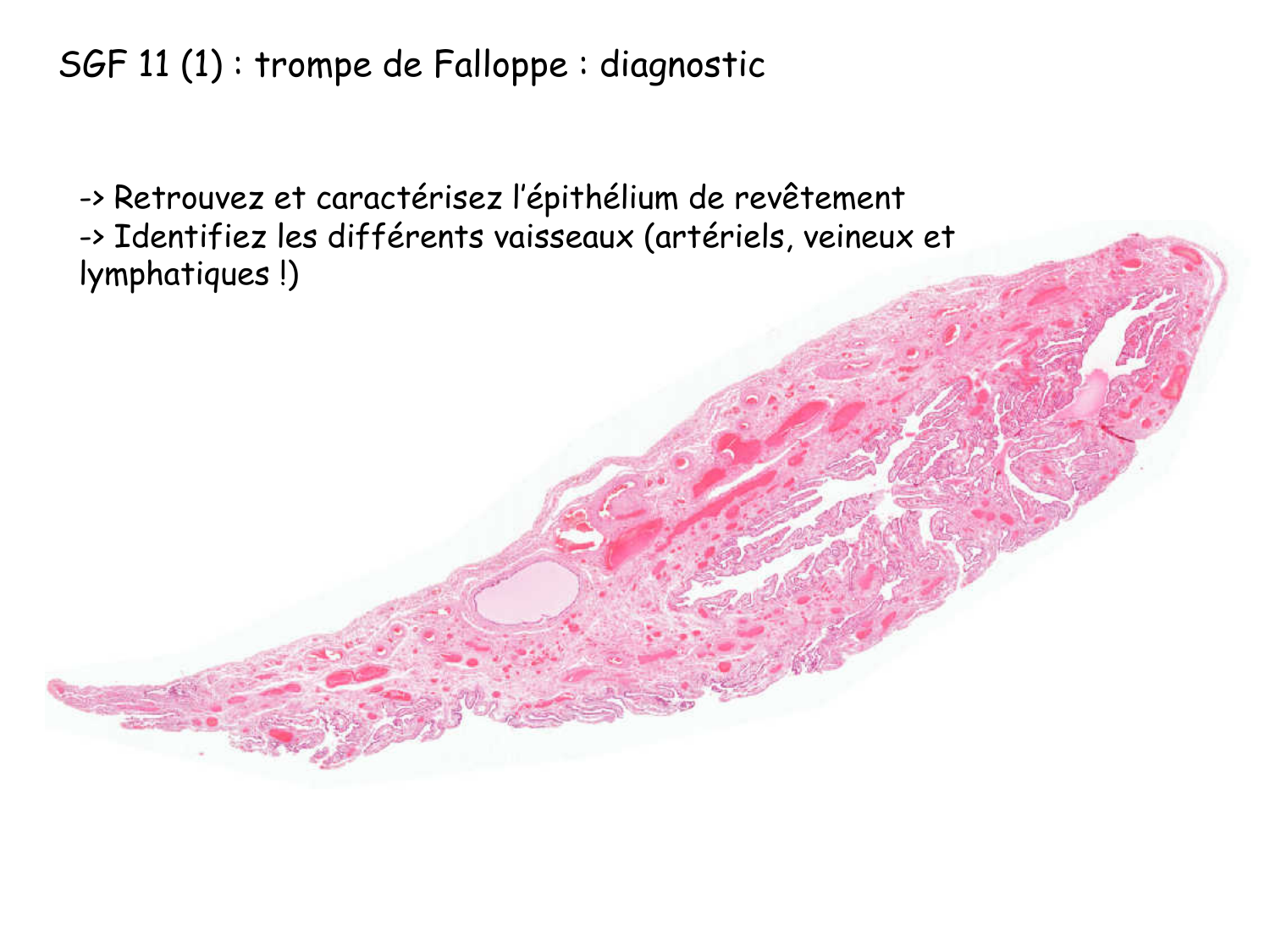 TP histologie — système circulatoire page 58