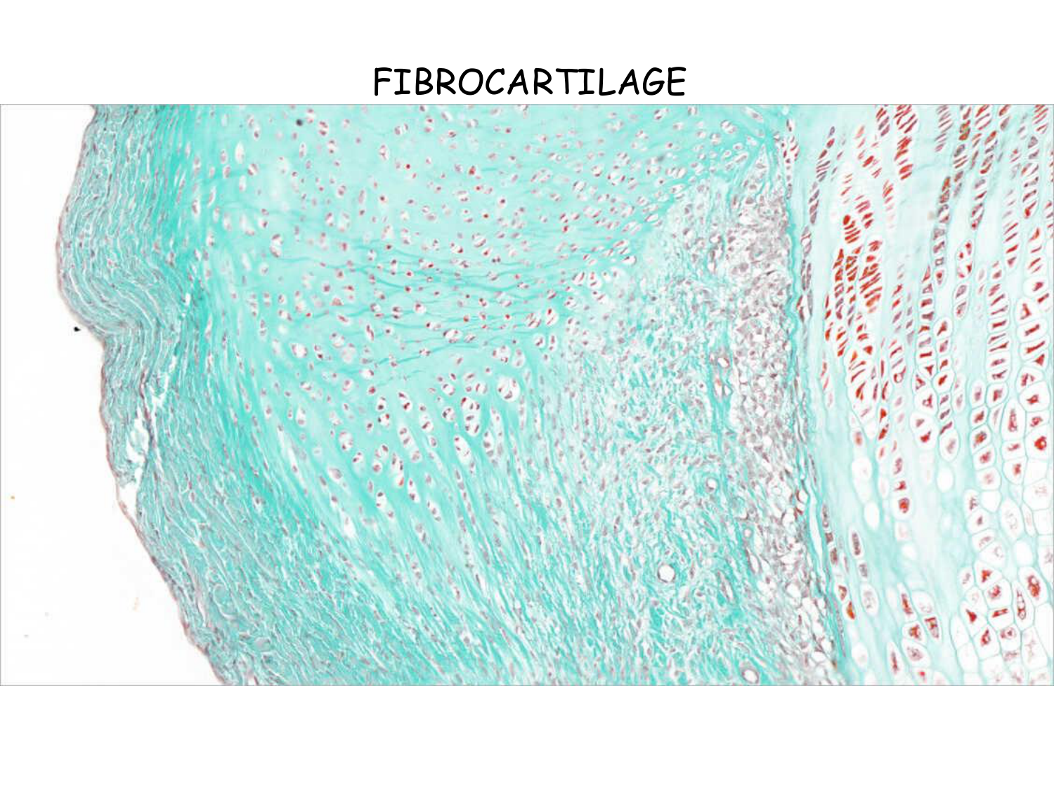 TP histologie — os et cartilage page 11