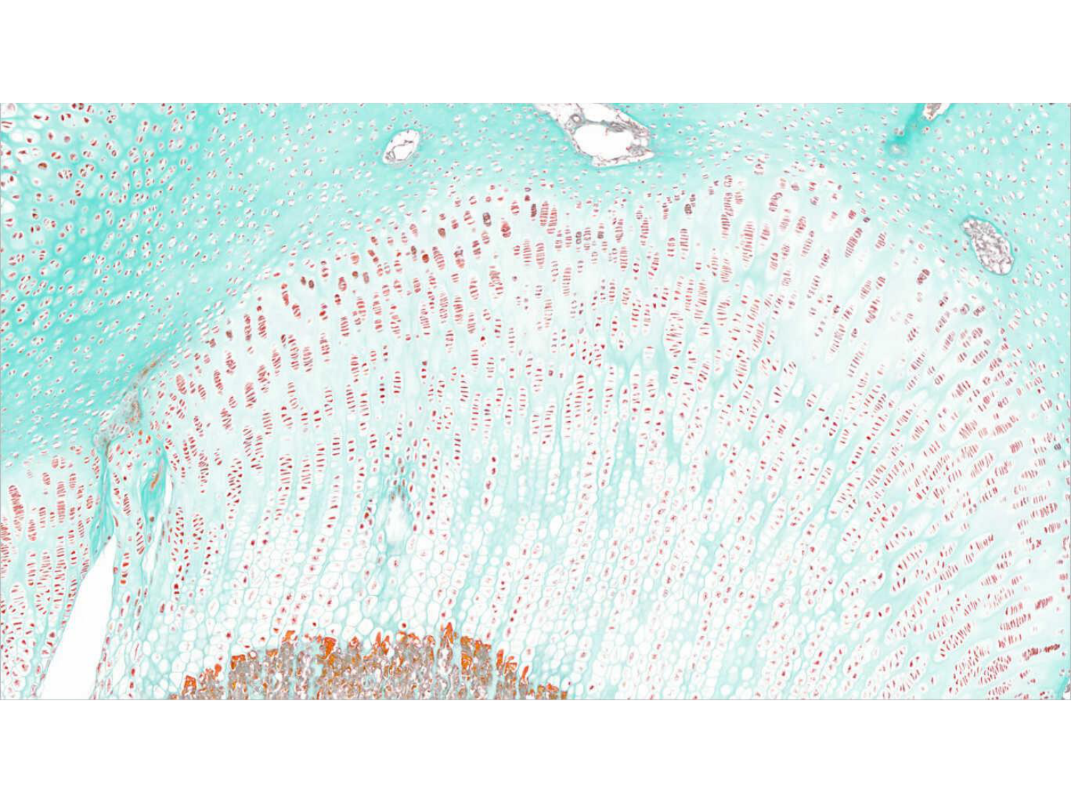 TP histologie — os et cartilage page 13
