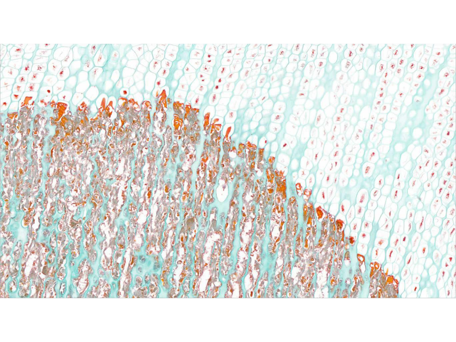 TP histologie — os et cartilage page 16