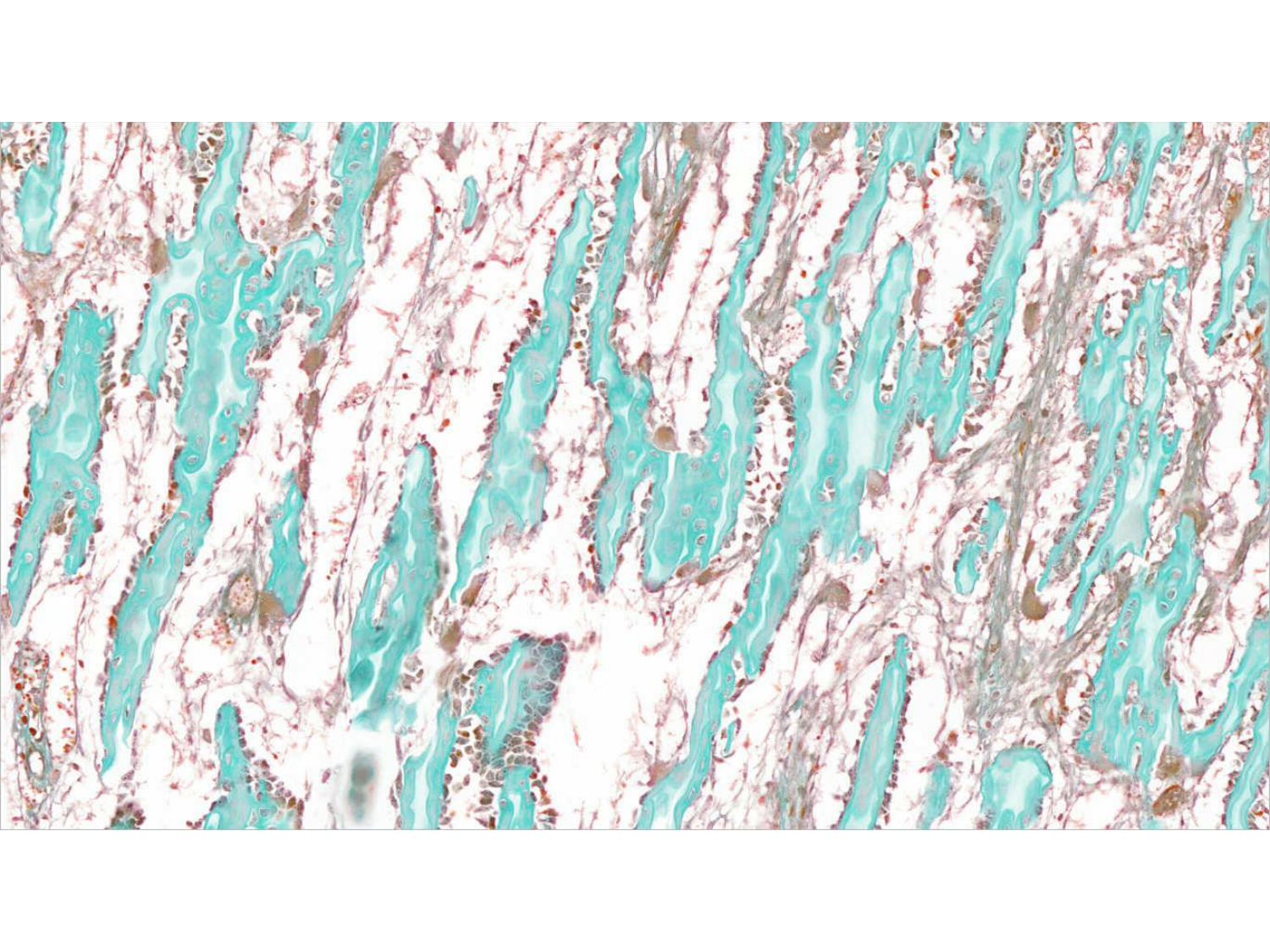 TP histologie — os et cartilage page 17