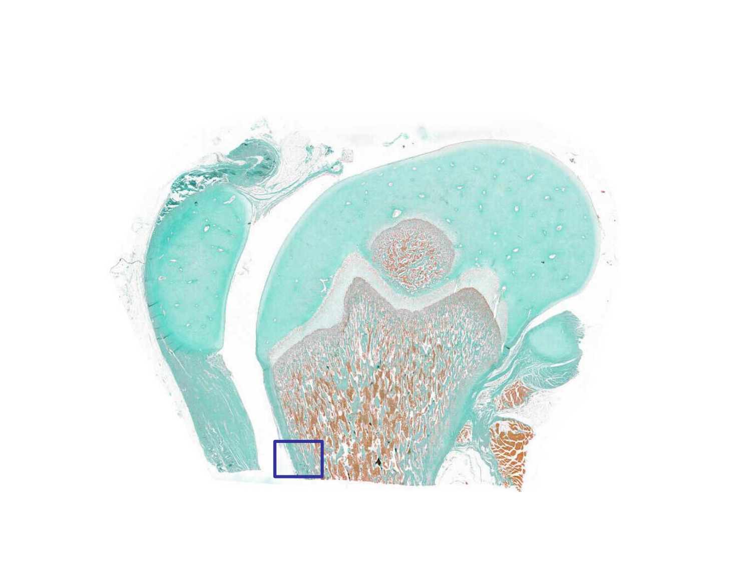 TP histologie — os et cartilage page 21