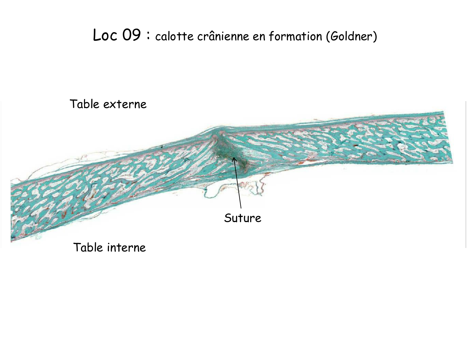 TP histologie — os et cartilage page 24