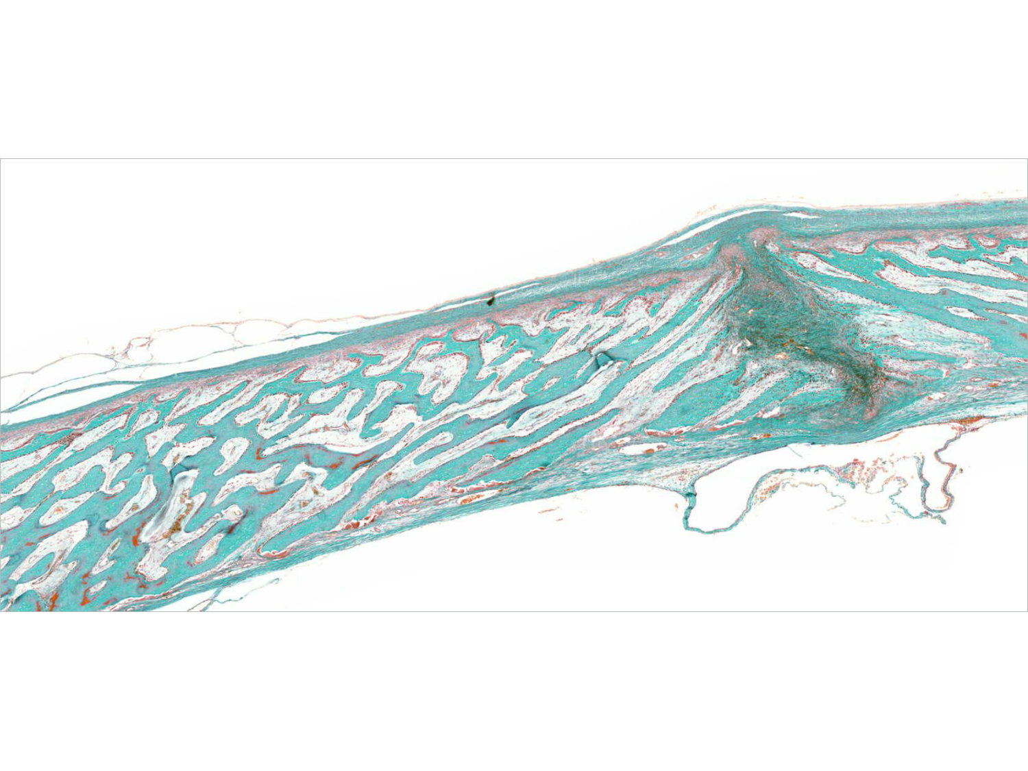 TP histologie — os et cartilage page 25