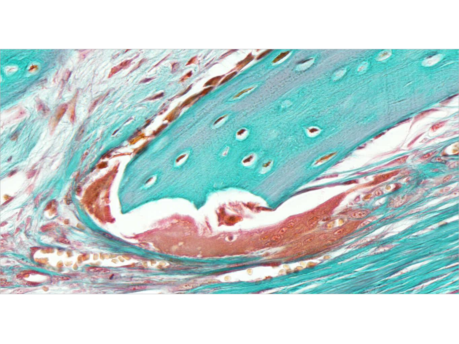 TP histologie — os et cartilage page 29