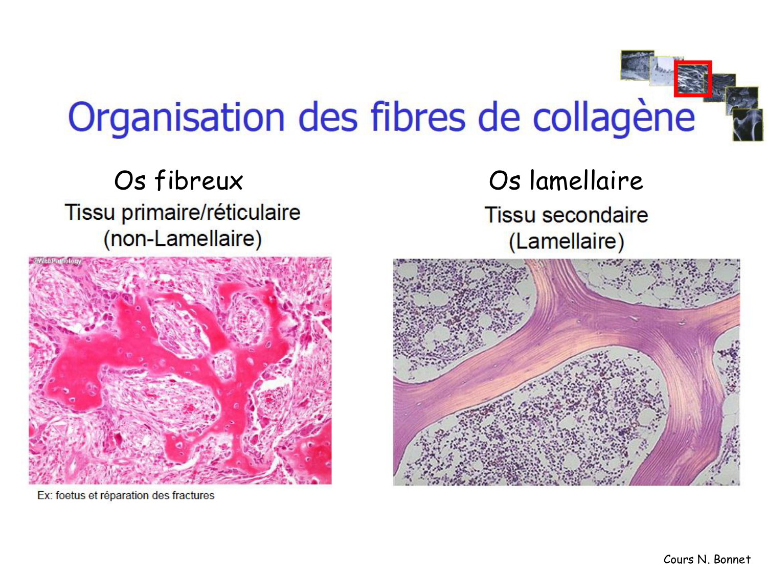 TP histologie — os et cartilage page 31