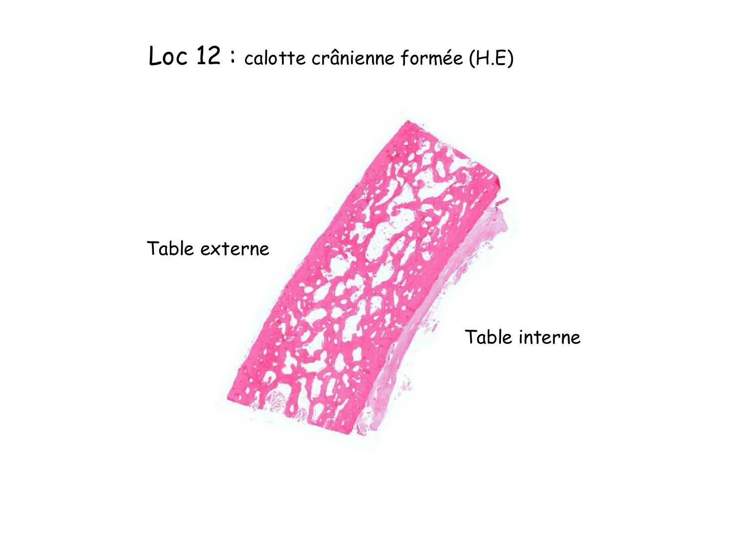 TP histologie — os et cartilage page 32