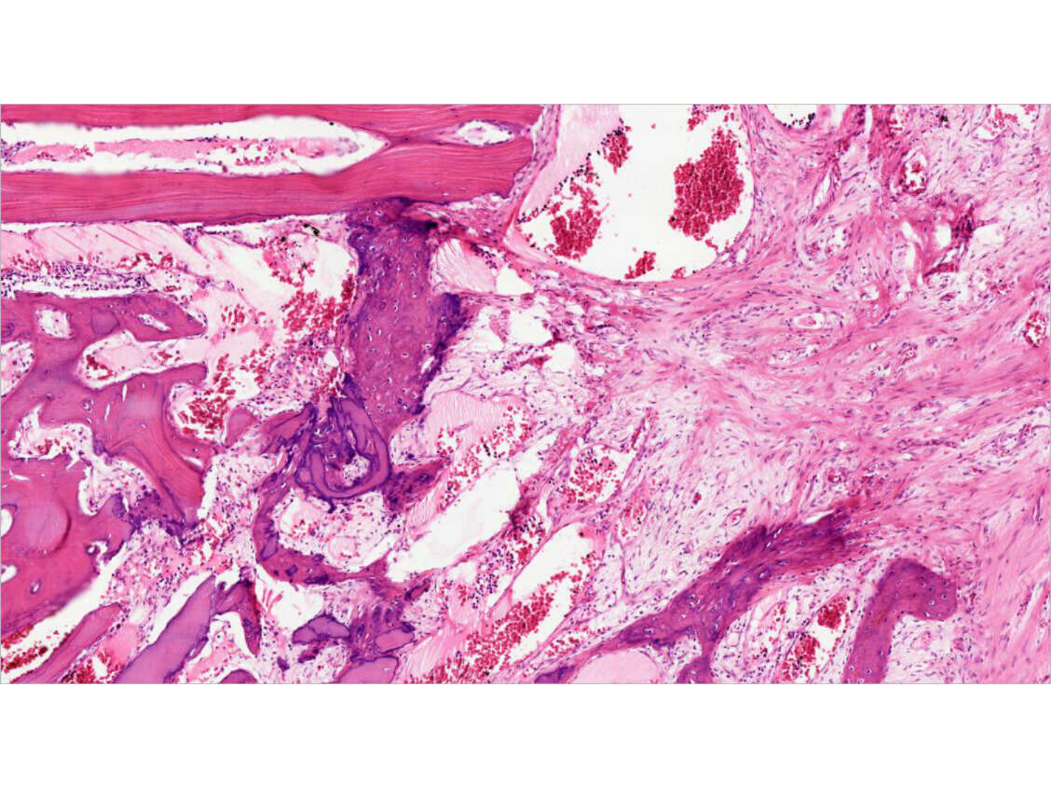TP histologie — os et cartilage page 42