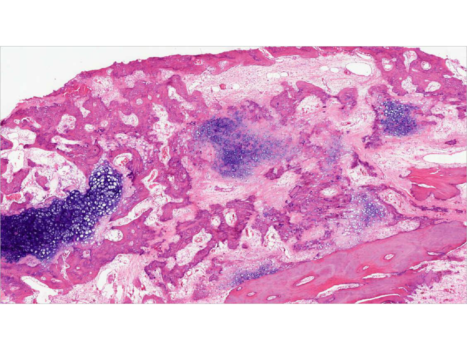 TP histologie — os et cartilage page 43
