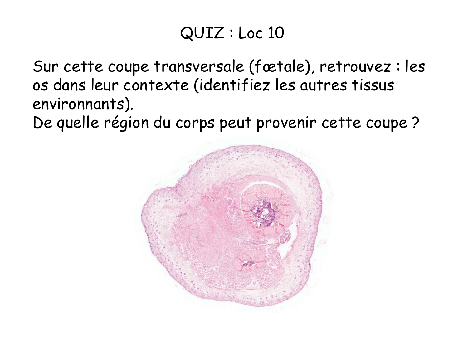 TP histologie — os et cartilage page 46