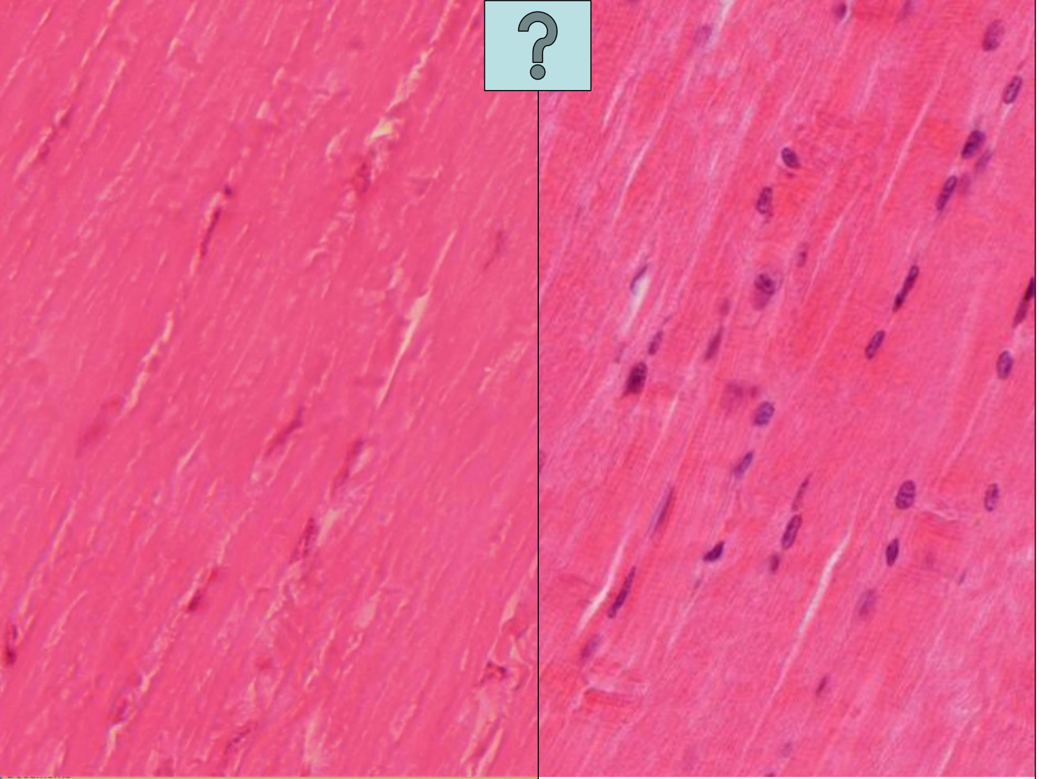 TP histologie — muscle page 13