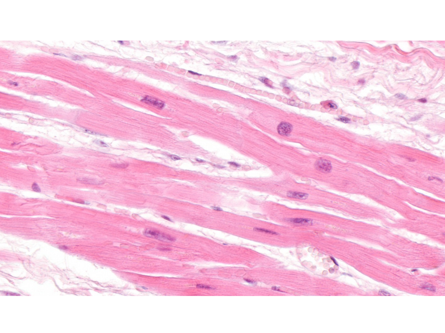 TP histologie — muscle page 17