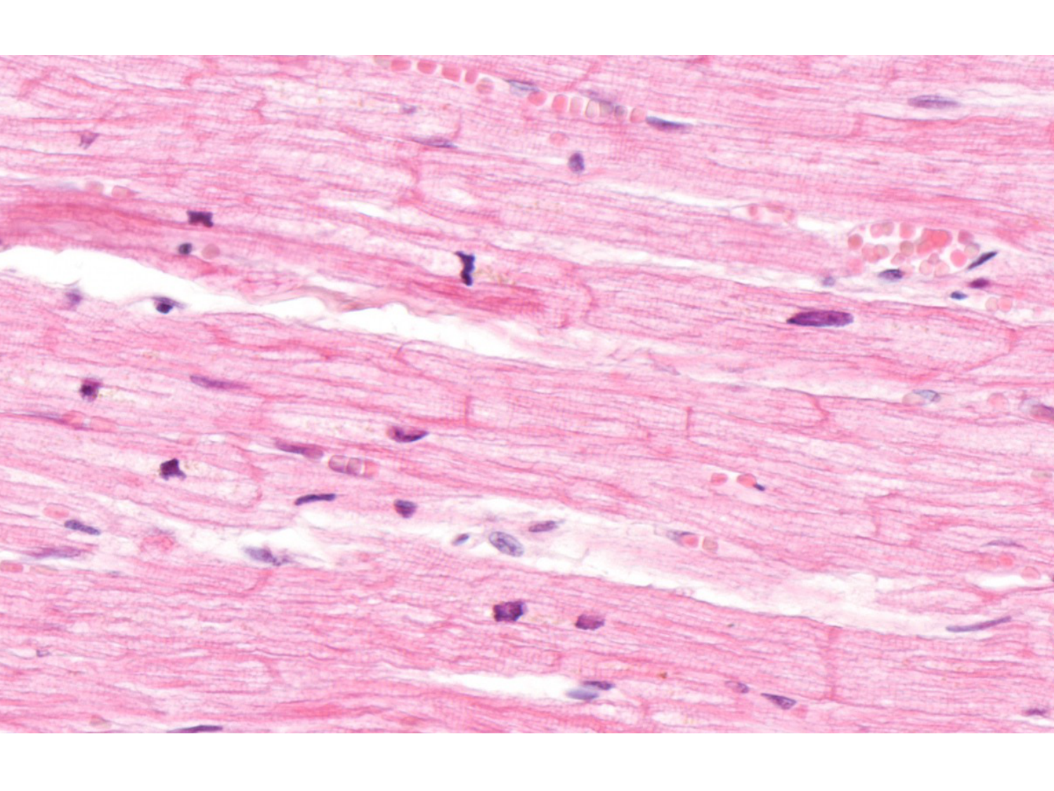 TP histologie — muscle page 18