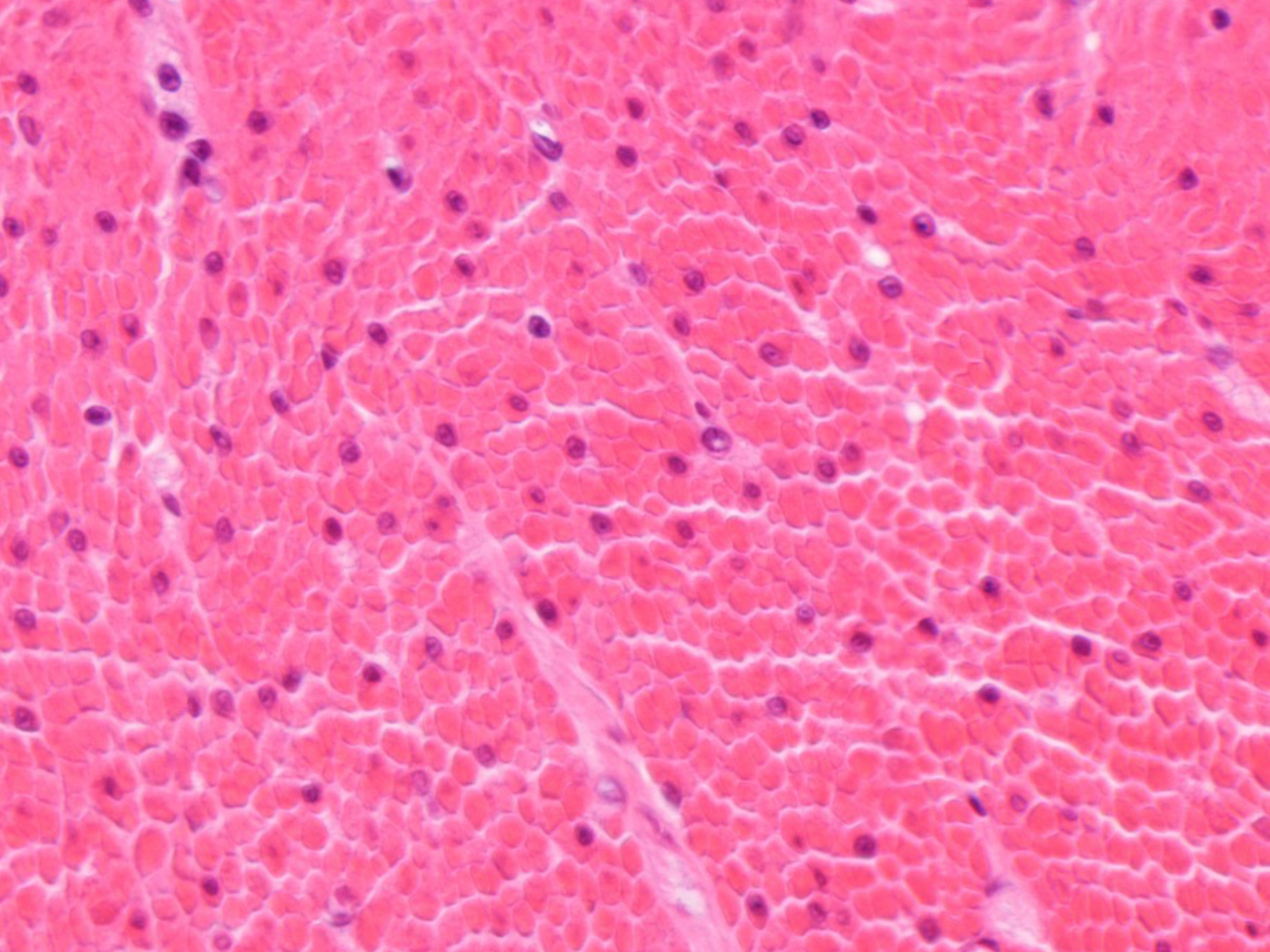 TP histologie — muscle page 25