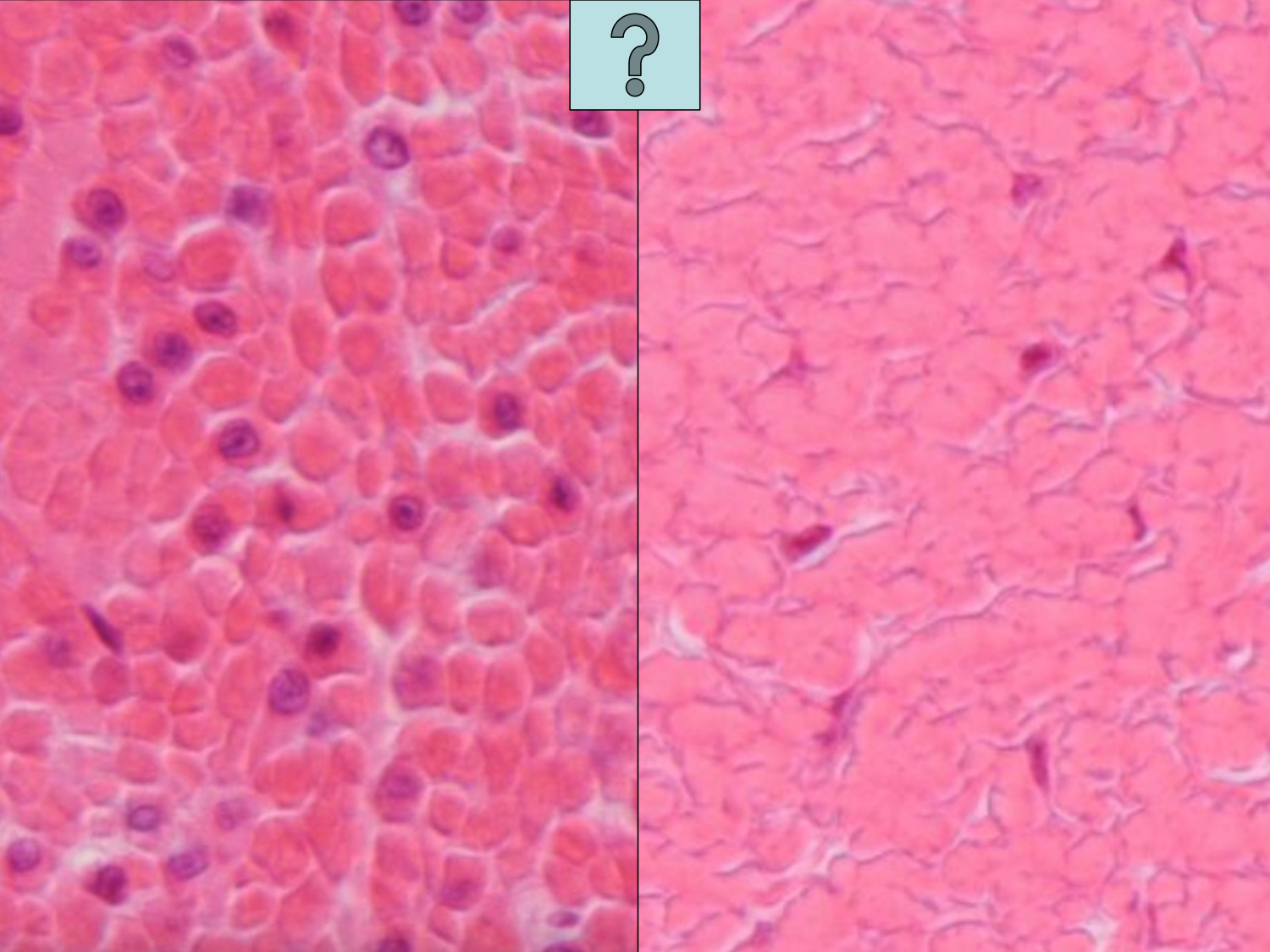 TP histologie — muscle page 28