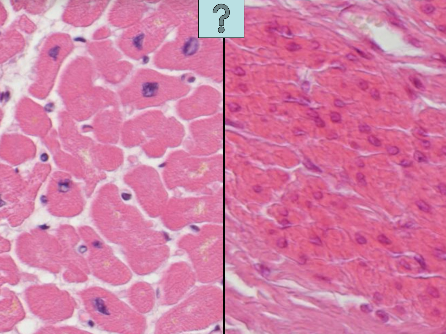 TP histologie — muscle page 29